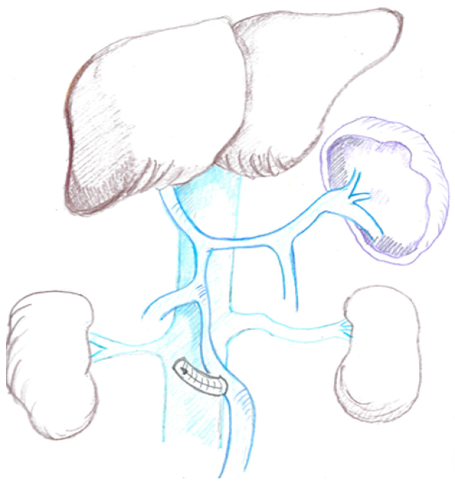 Cancers 16 02361 g001