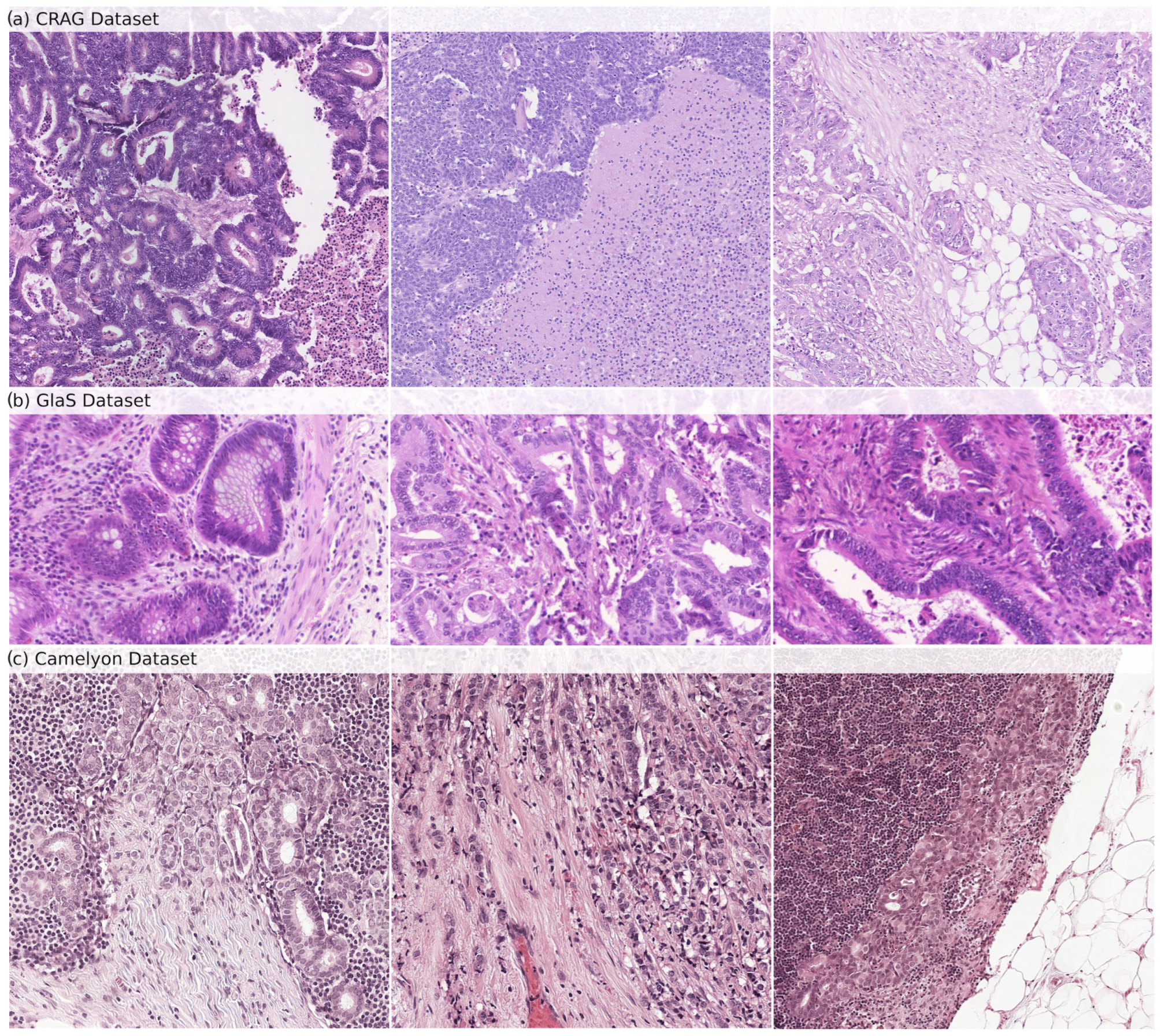 Cancers 16 02391 g001