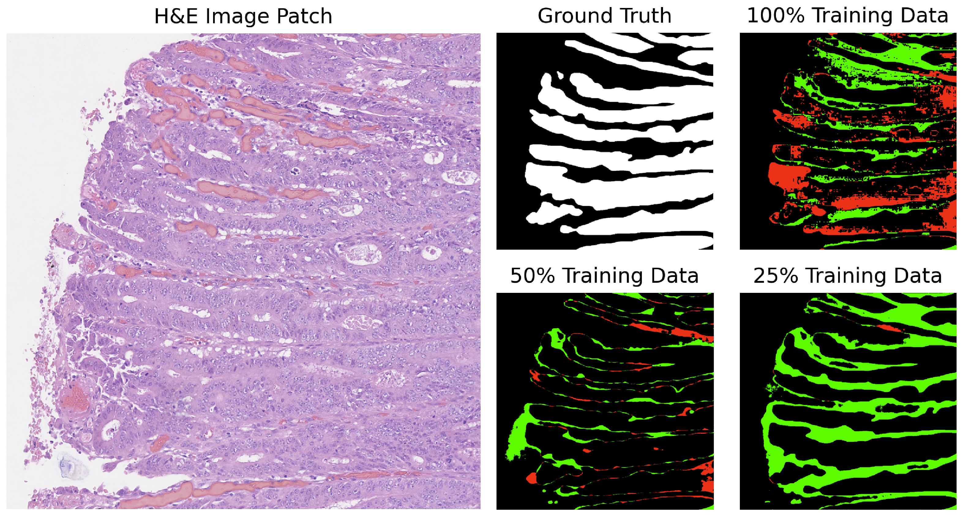 Cancers 16 02391 g005