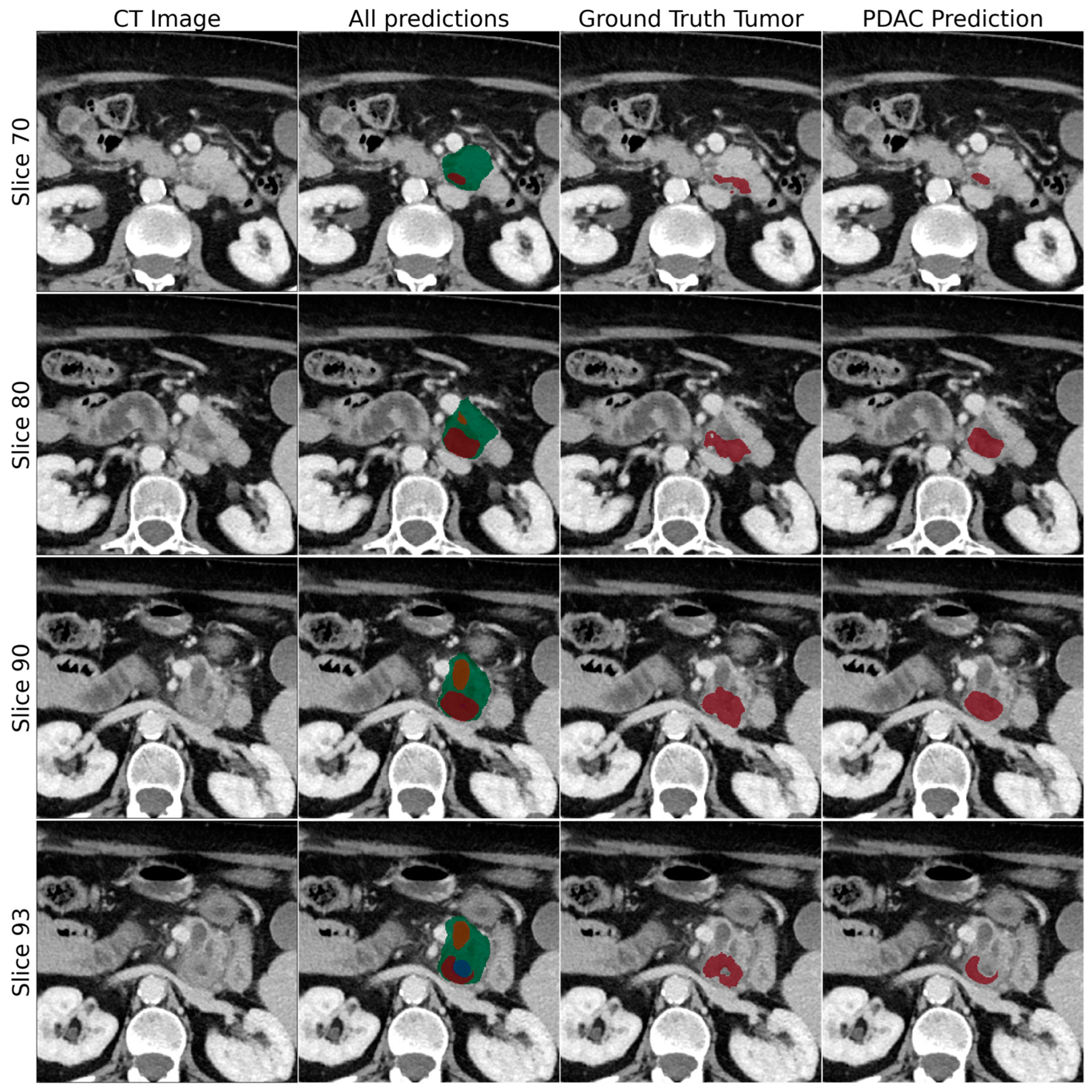 Cancers 16 02403 g004