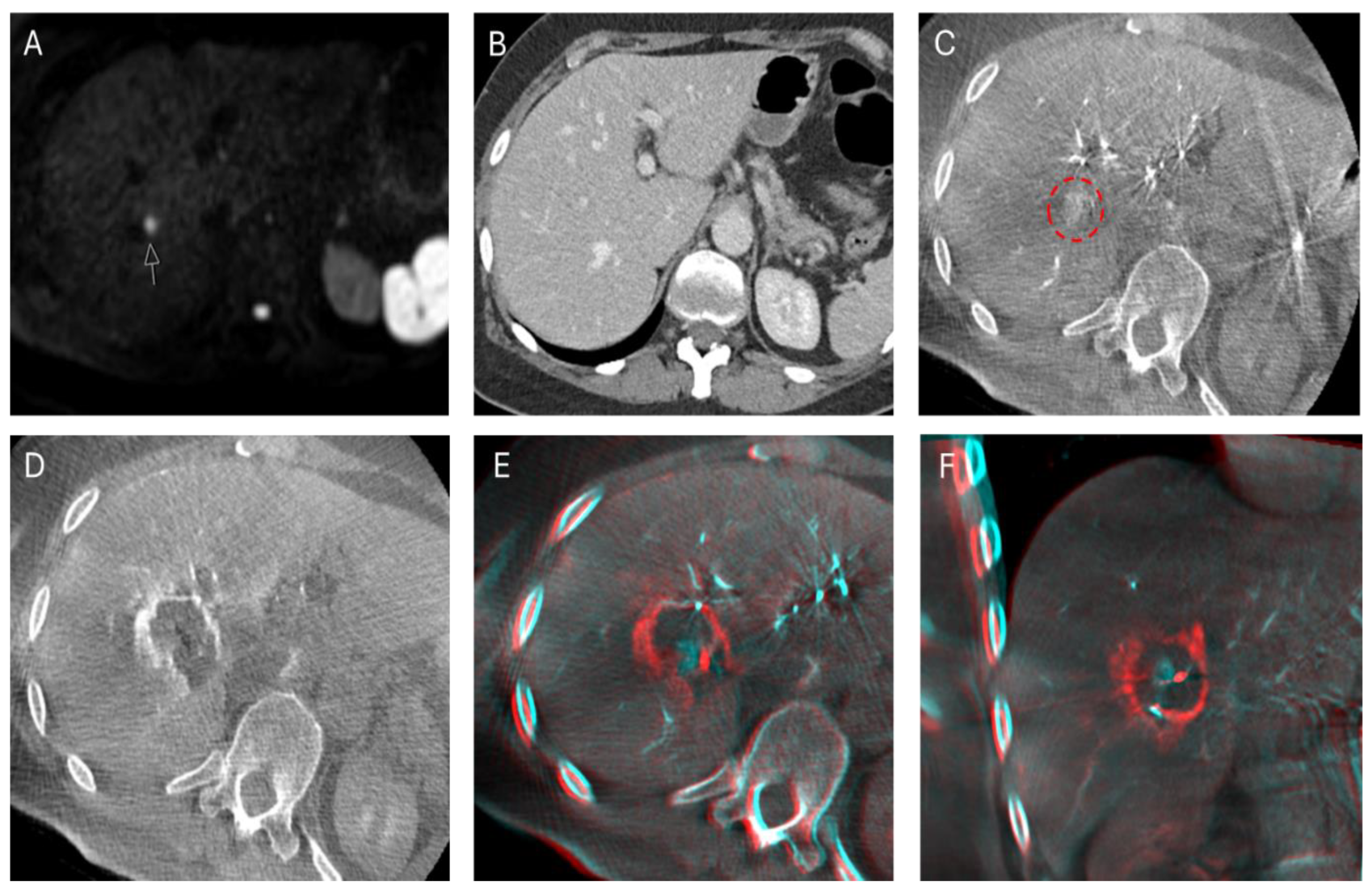 Cancers 16 02409 g002