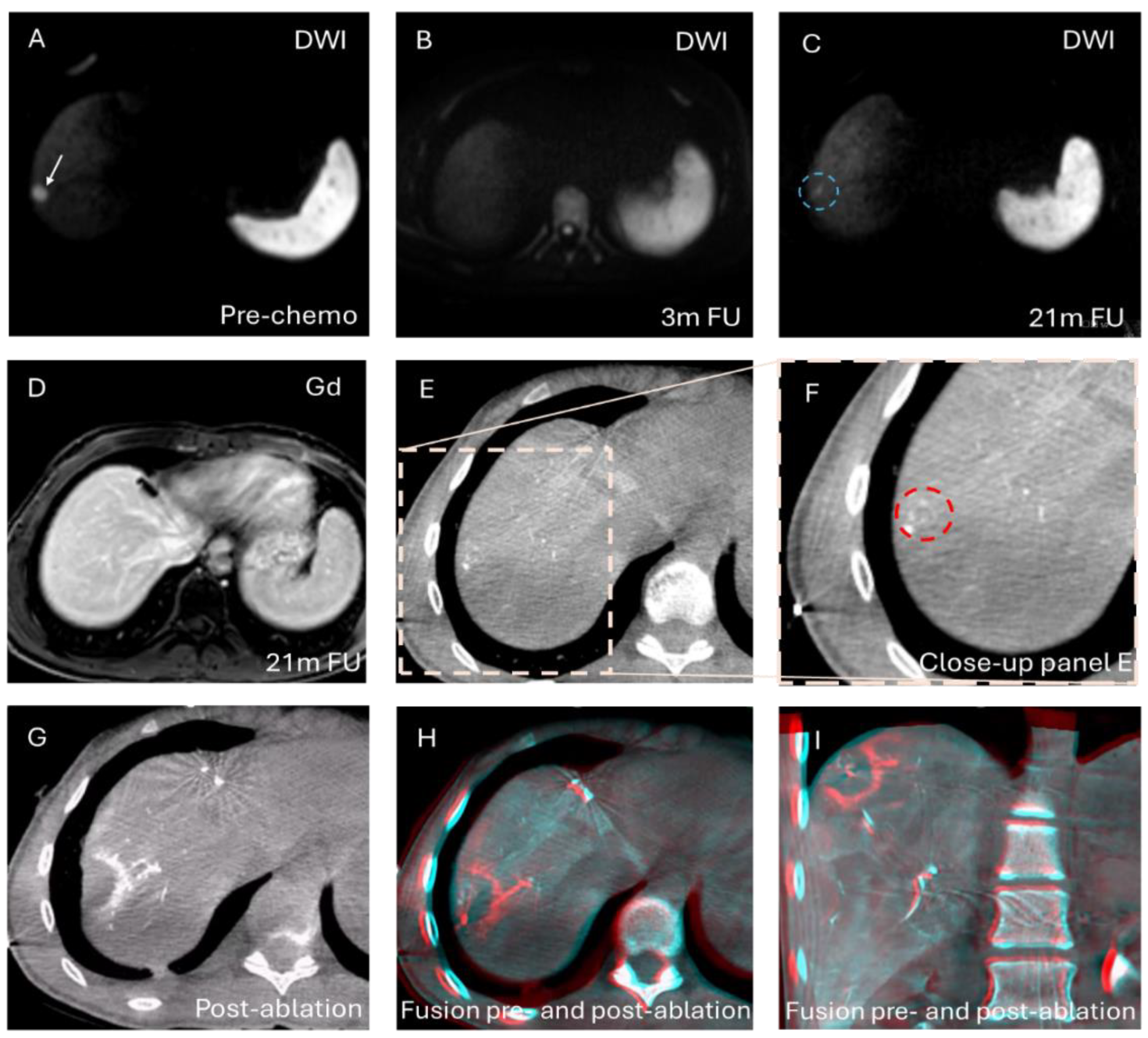 Cancers 16 02409 g003