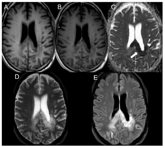 Cancers 16 02440 g001