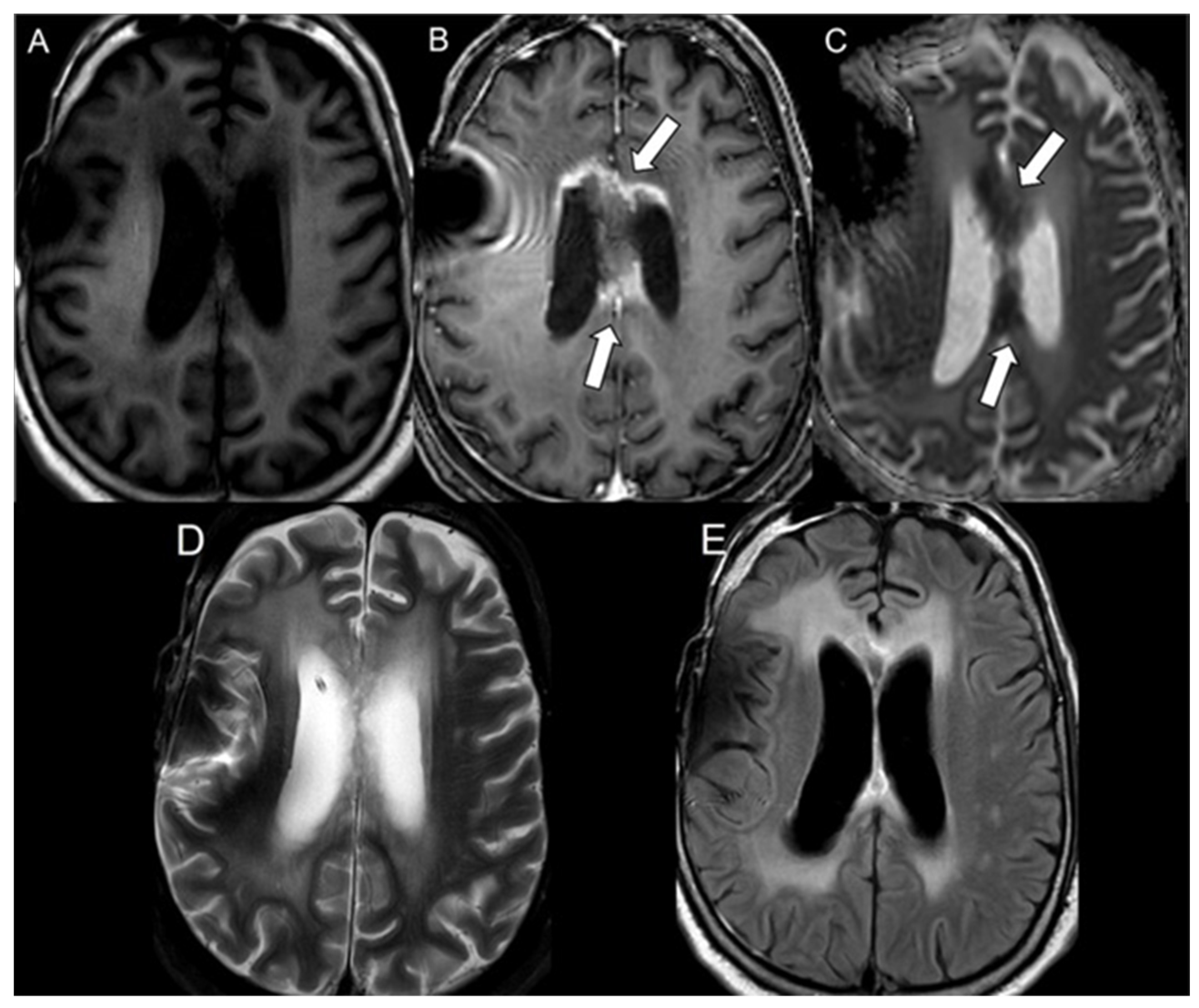 Cancers 16 02440 g002