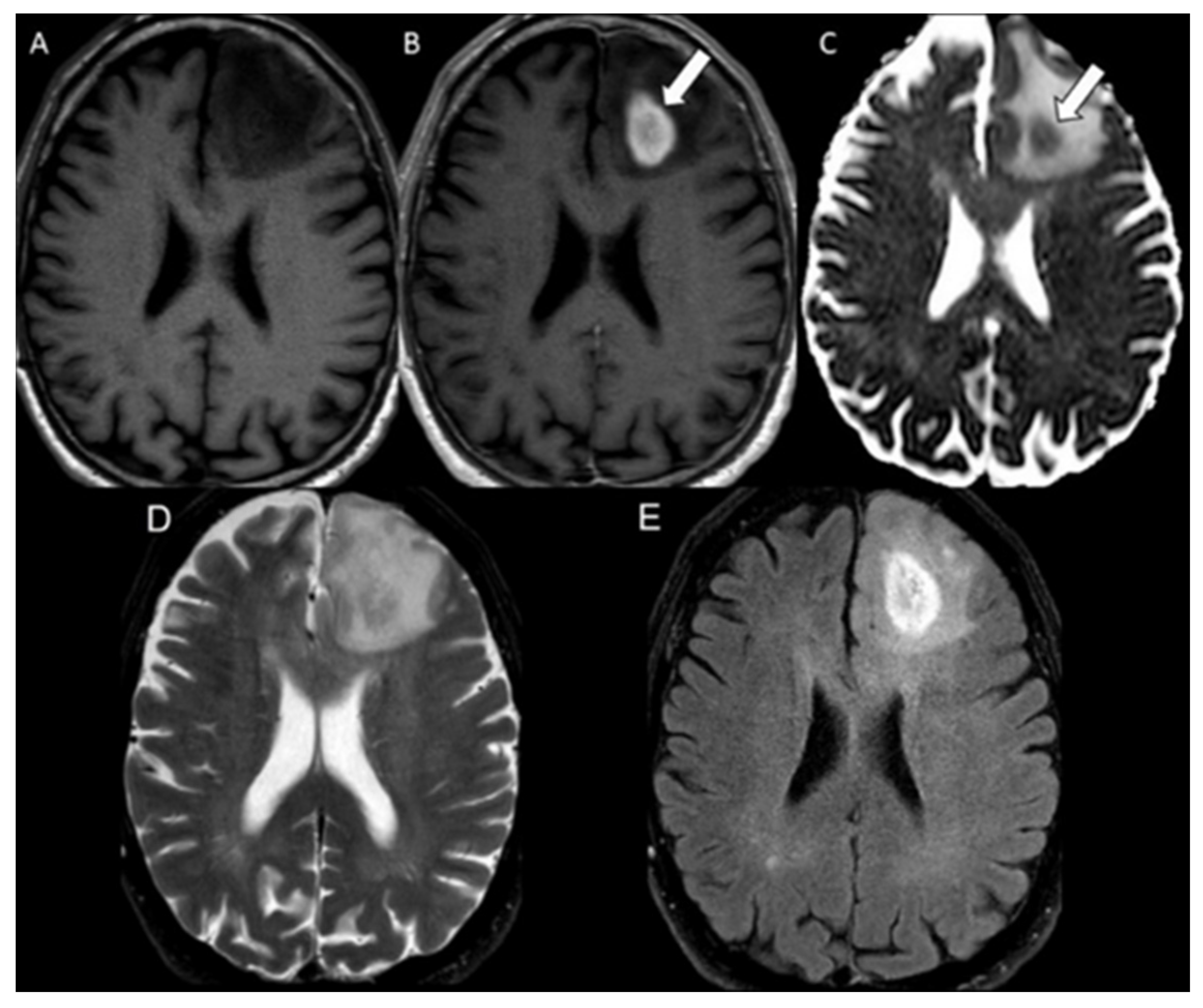 Cancers 16 02440 g003