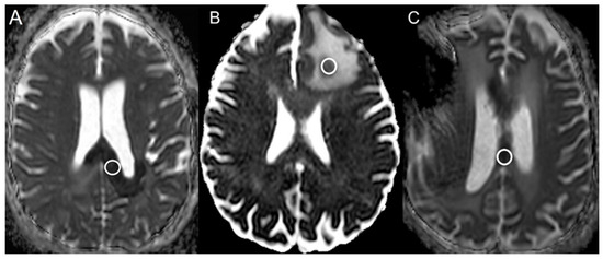 Cancers 16 02440 g004