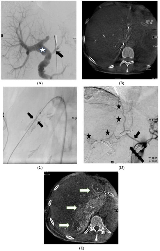 Cancers 16 02459 g002