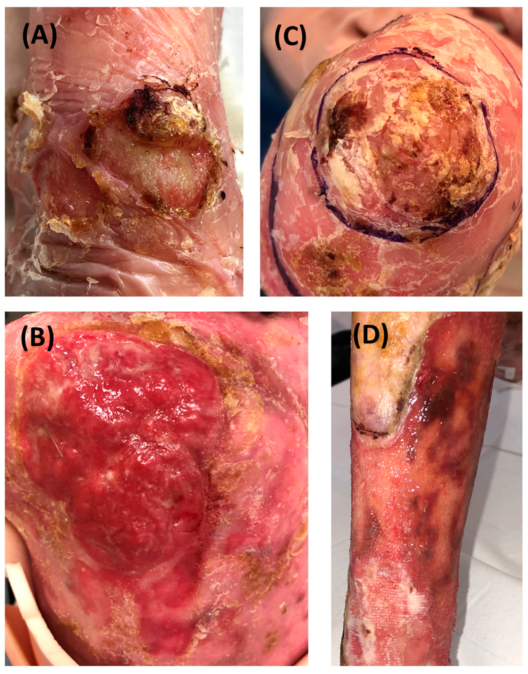 Cancers 16 02476 g002