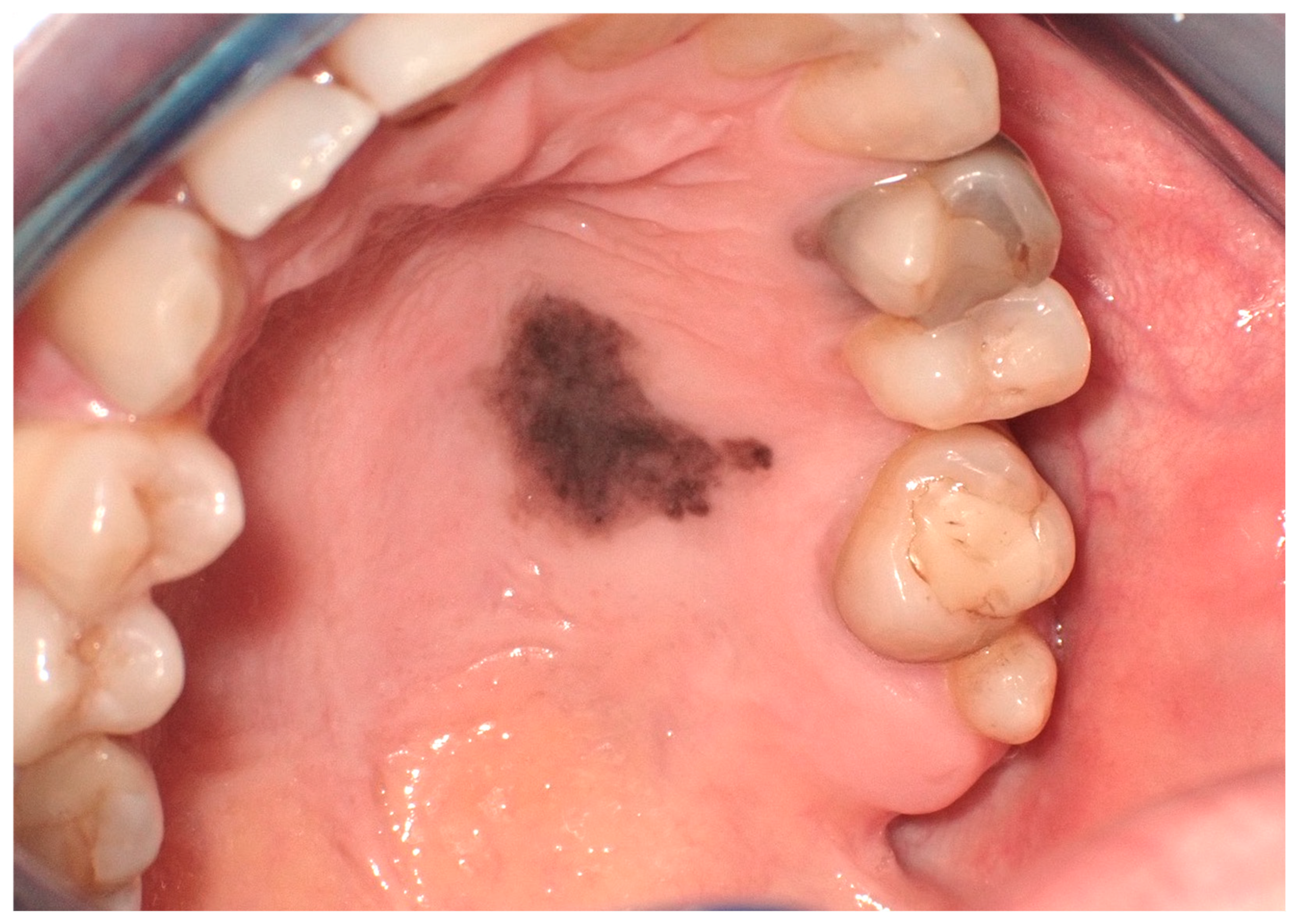 Cancers 16 02487 g005