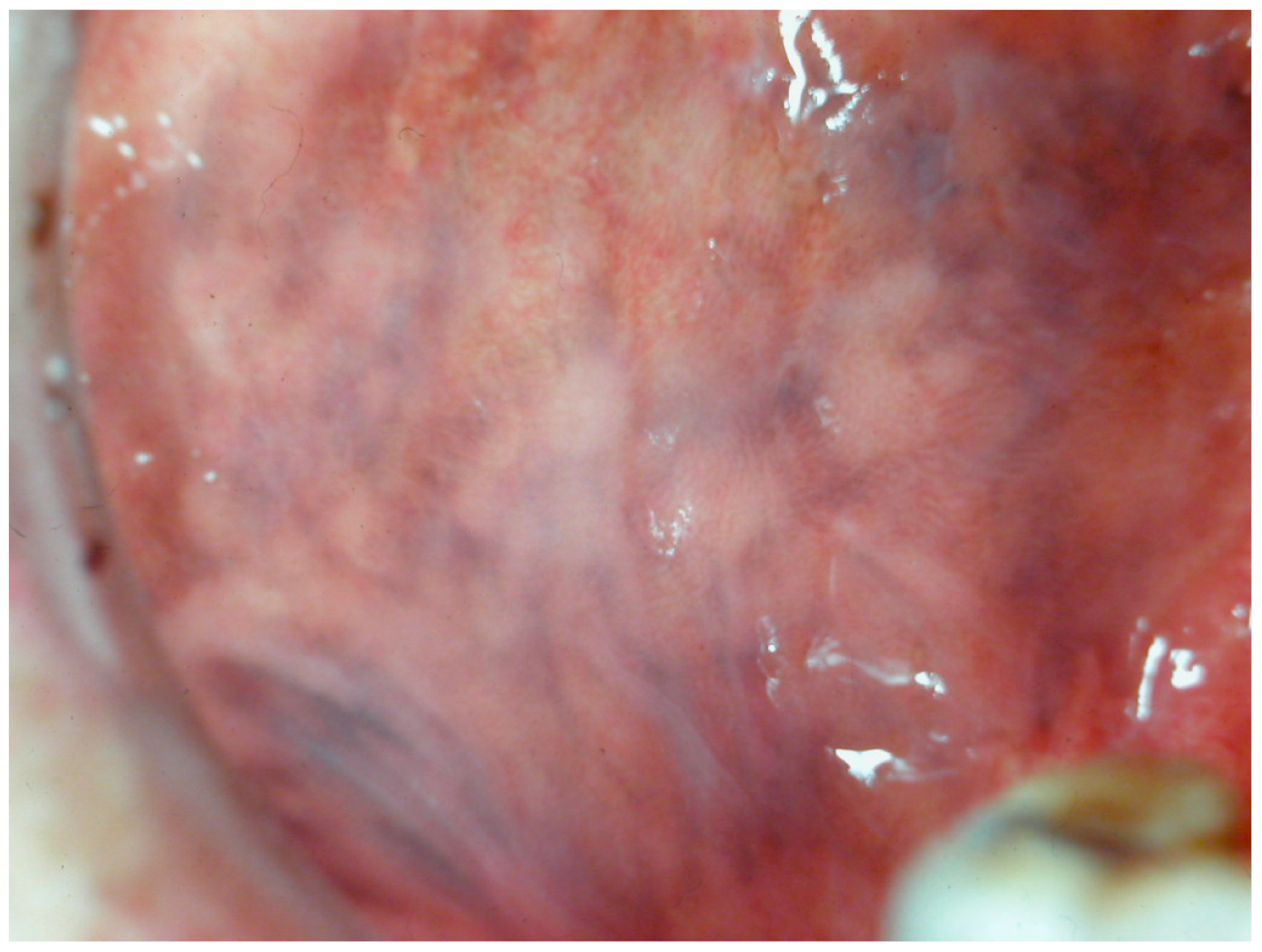 Cancers 16 02487 g011