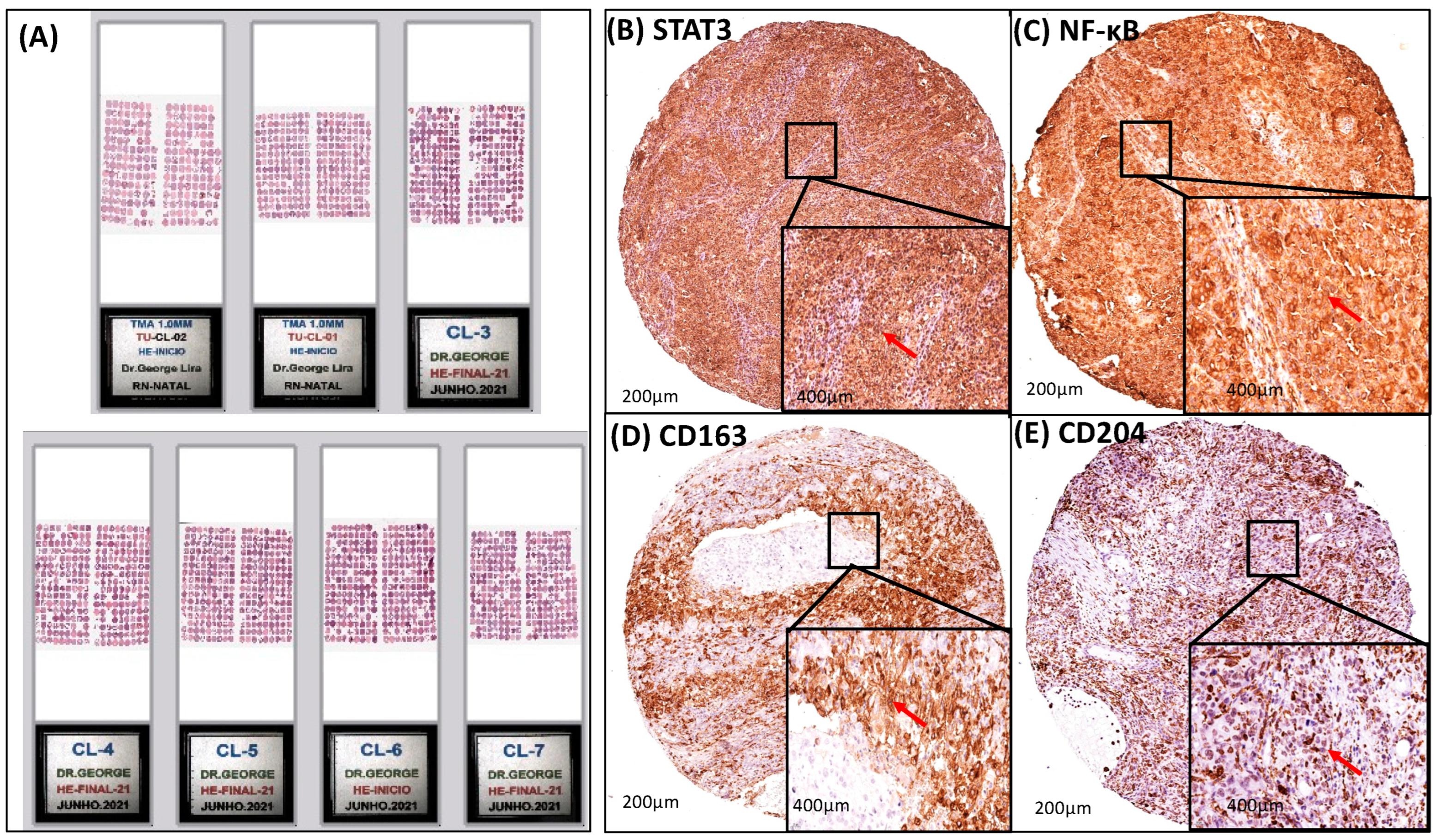 Cancers 16 02496 g002