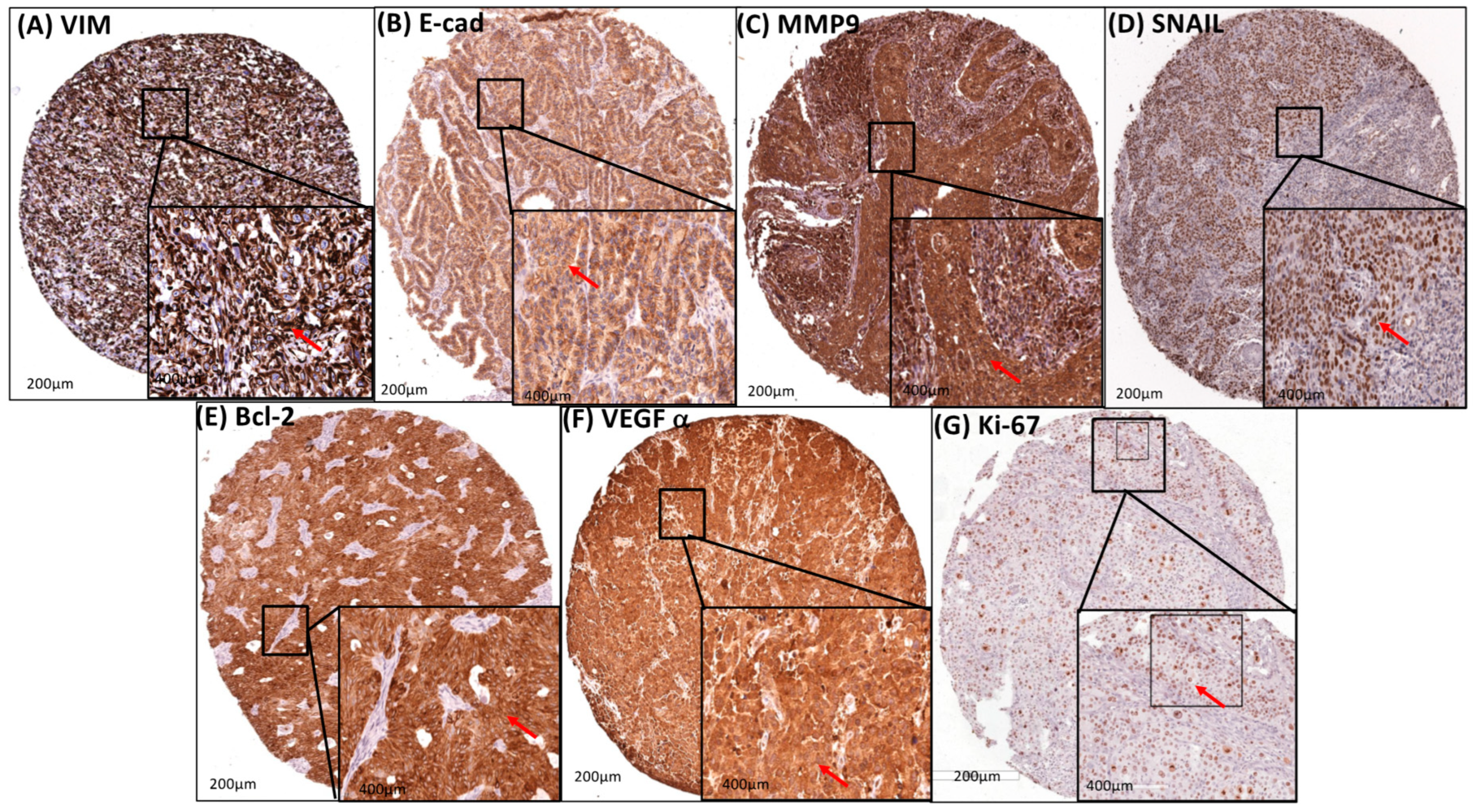 Cancers 16 02496 g003