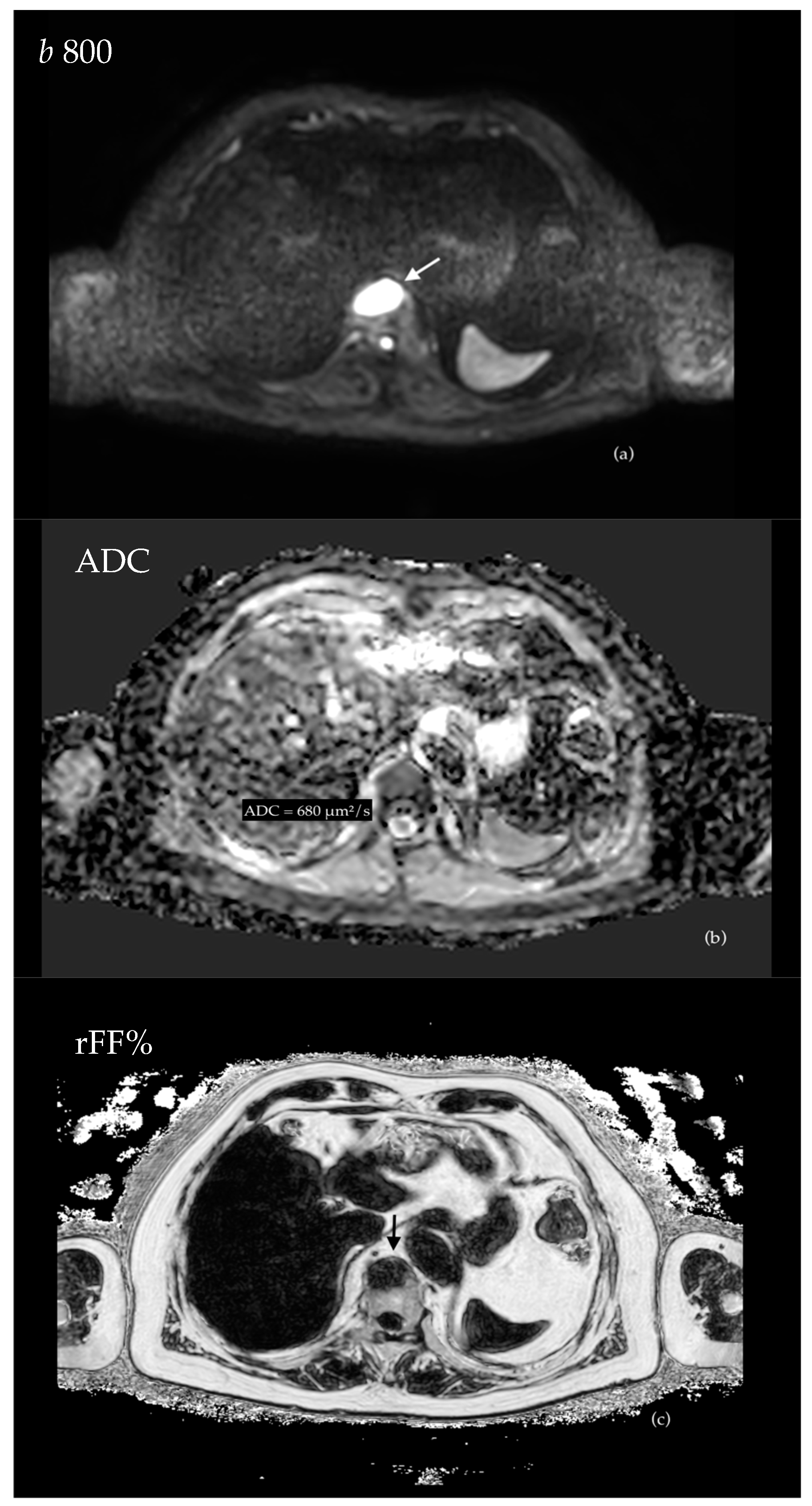 Cancers 16 02531 g002