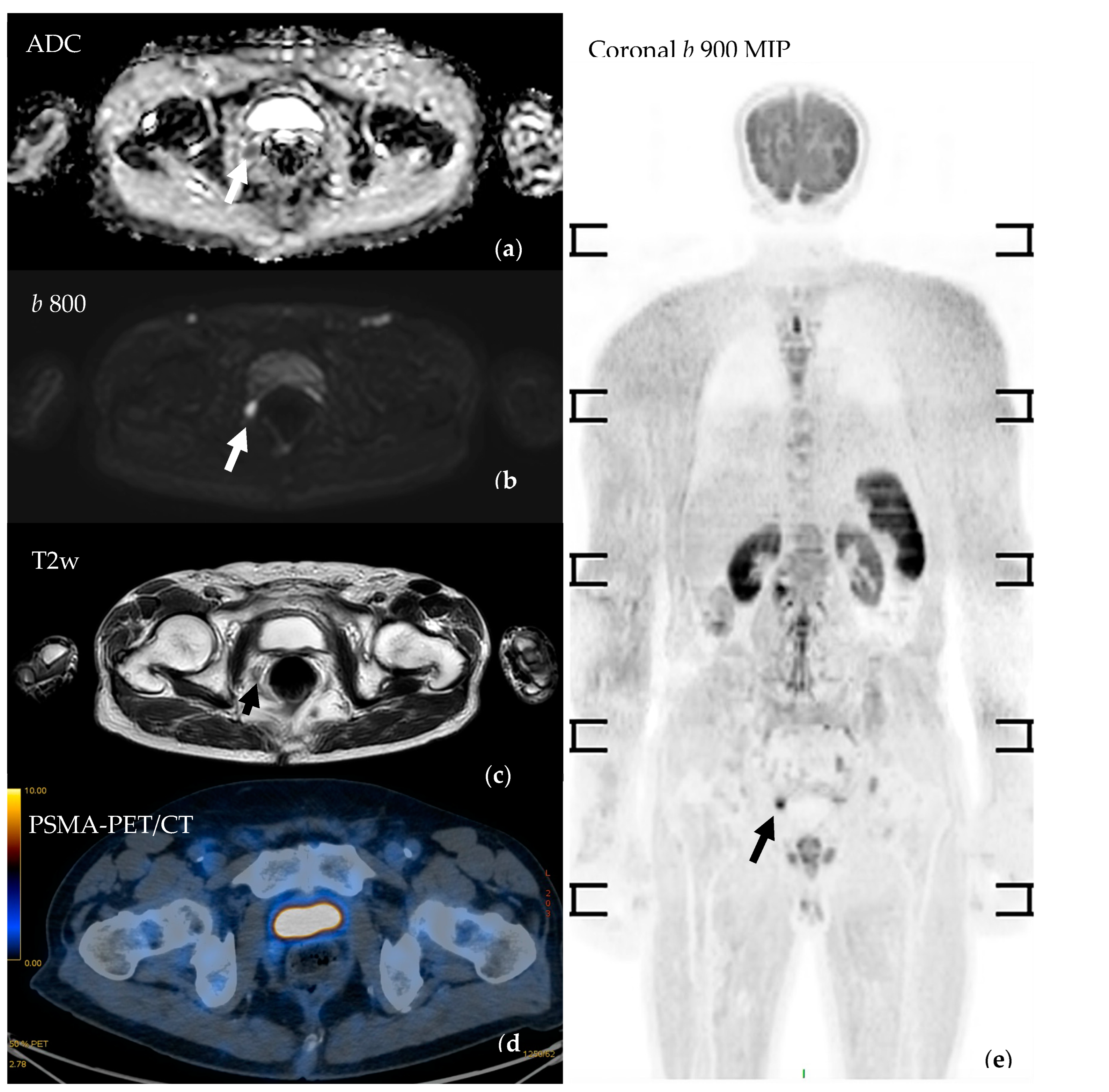 Cancers 16 02531 g004