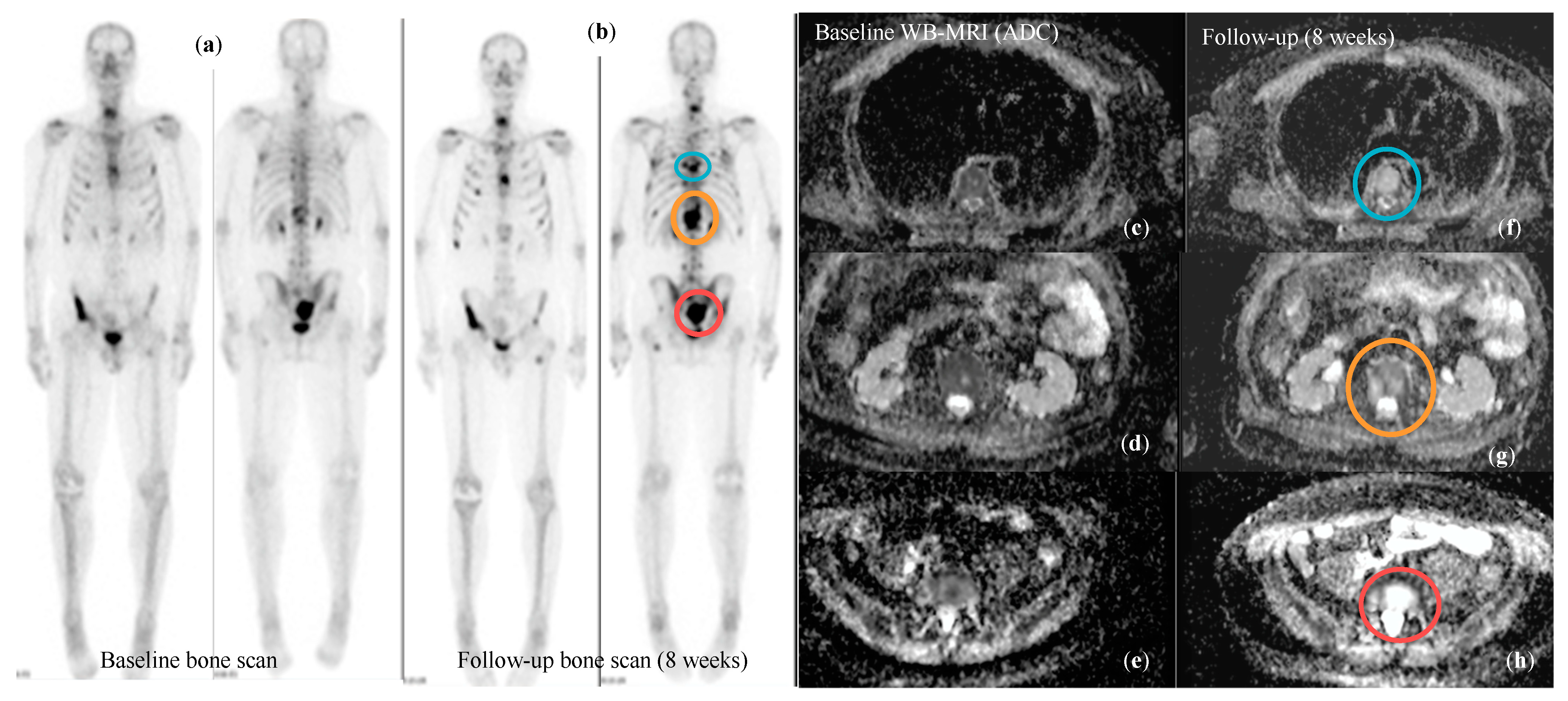 Cancers 16 02531 g005