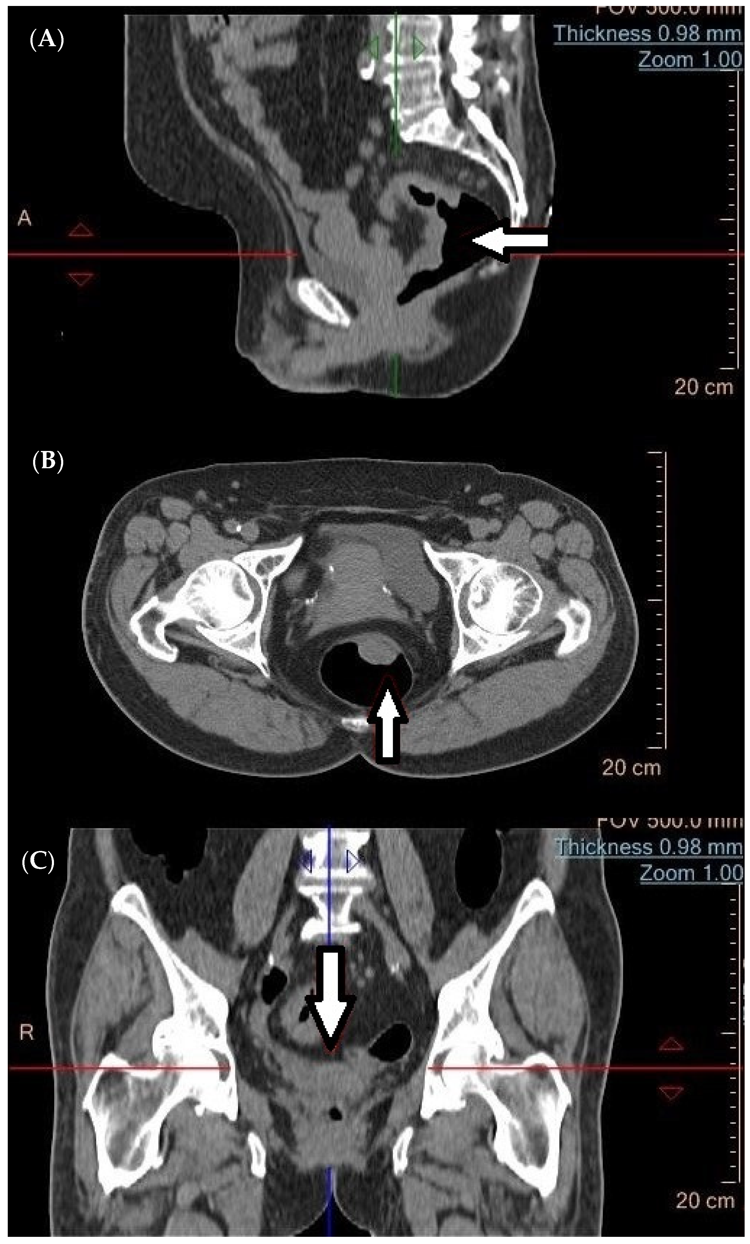 Cancers 16 02553 g001