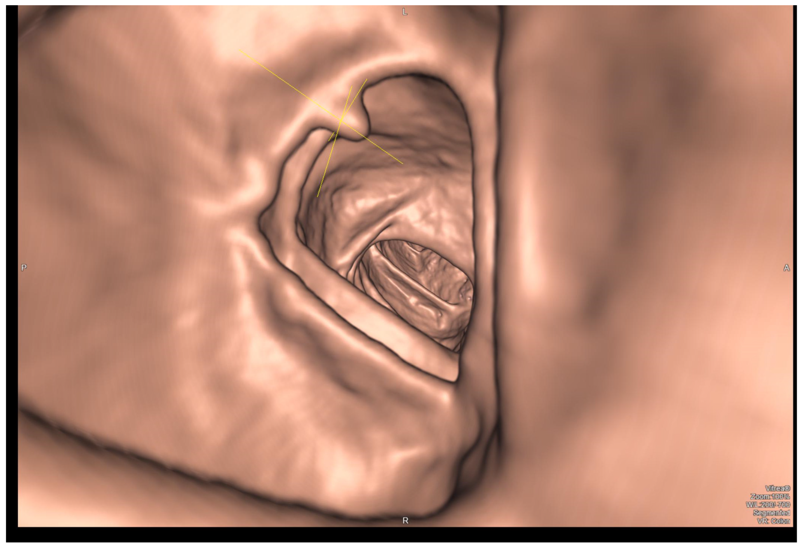 Cancers 16 02553 g002