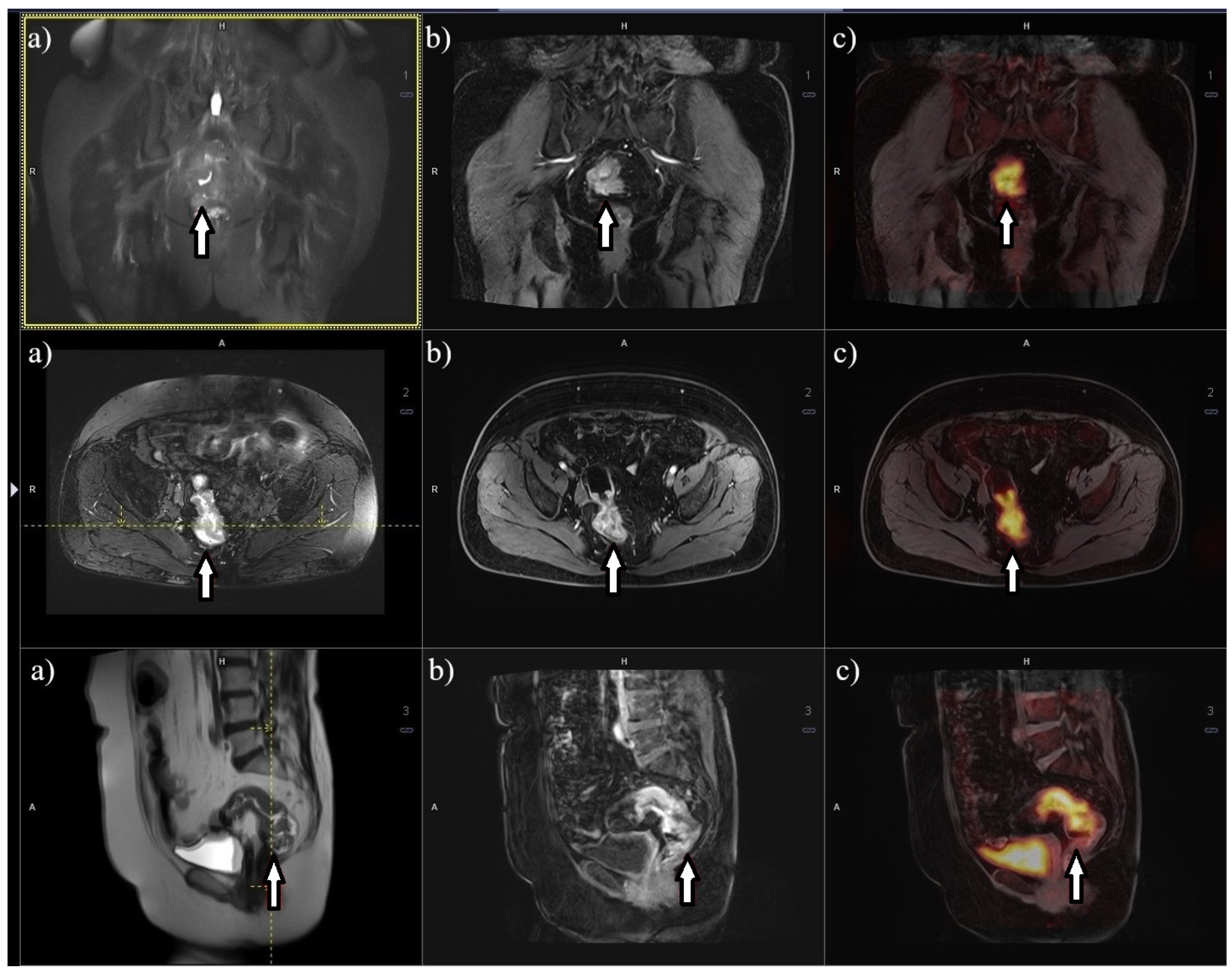 Cancers 16 02553 g003