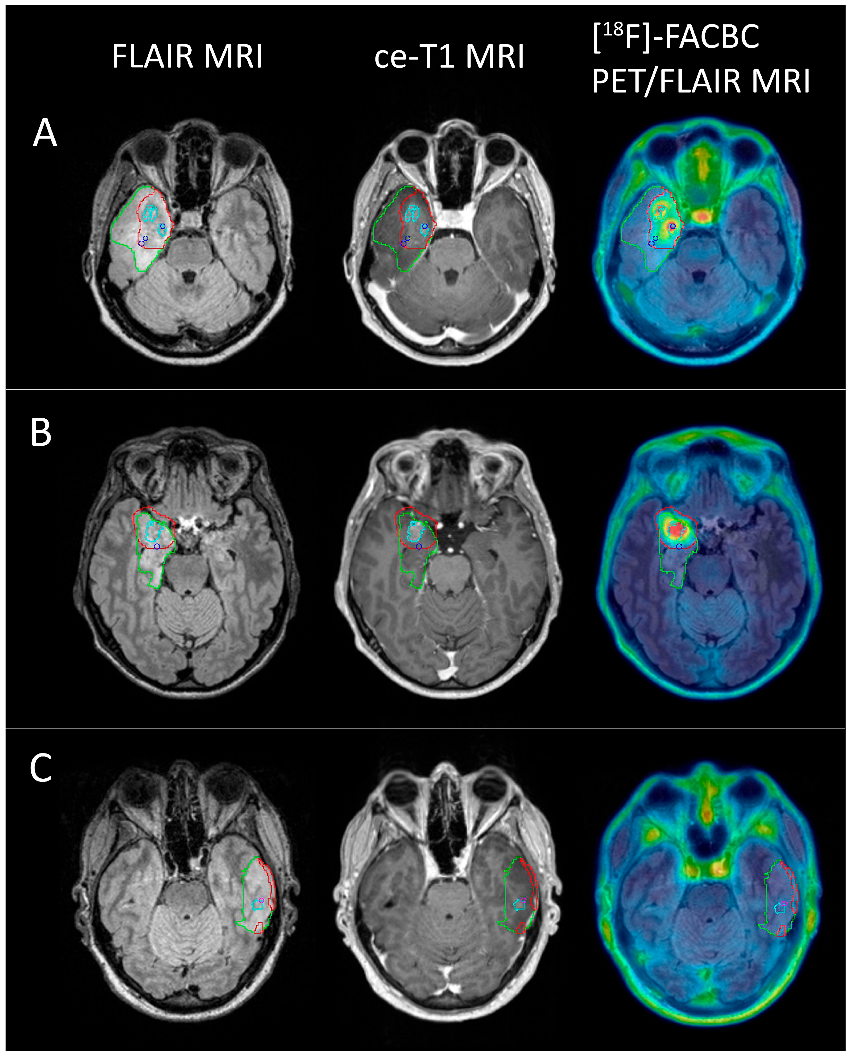 Cancers 16 02581 g006