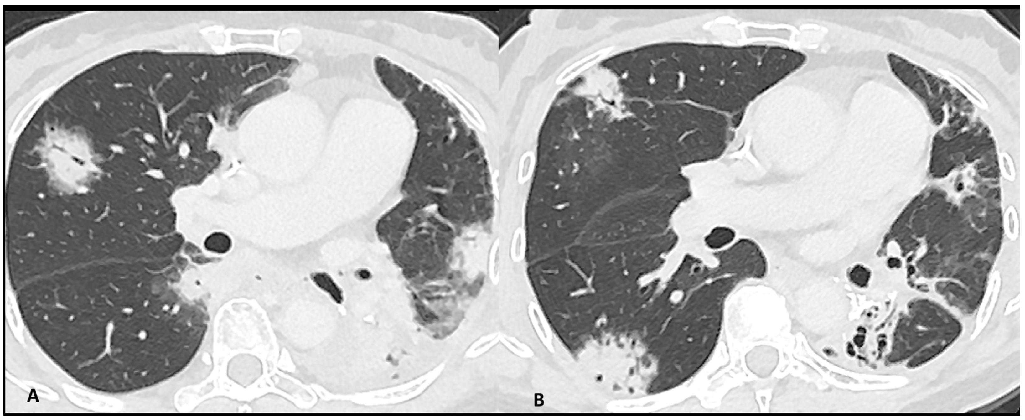 Cancers 16 02585 g002