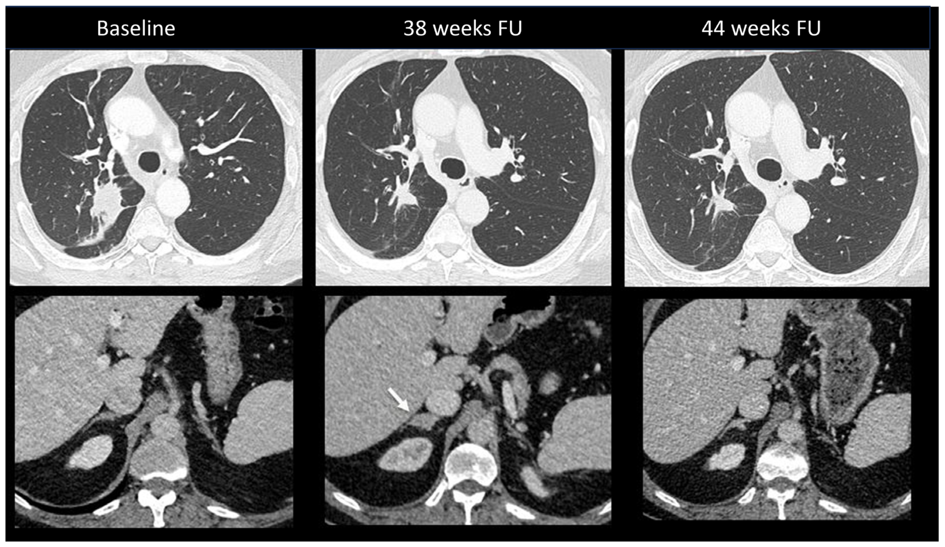 Cancers 16 02585 g011