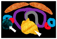 Cancers 16 02593 i003