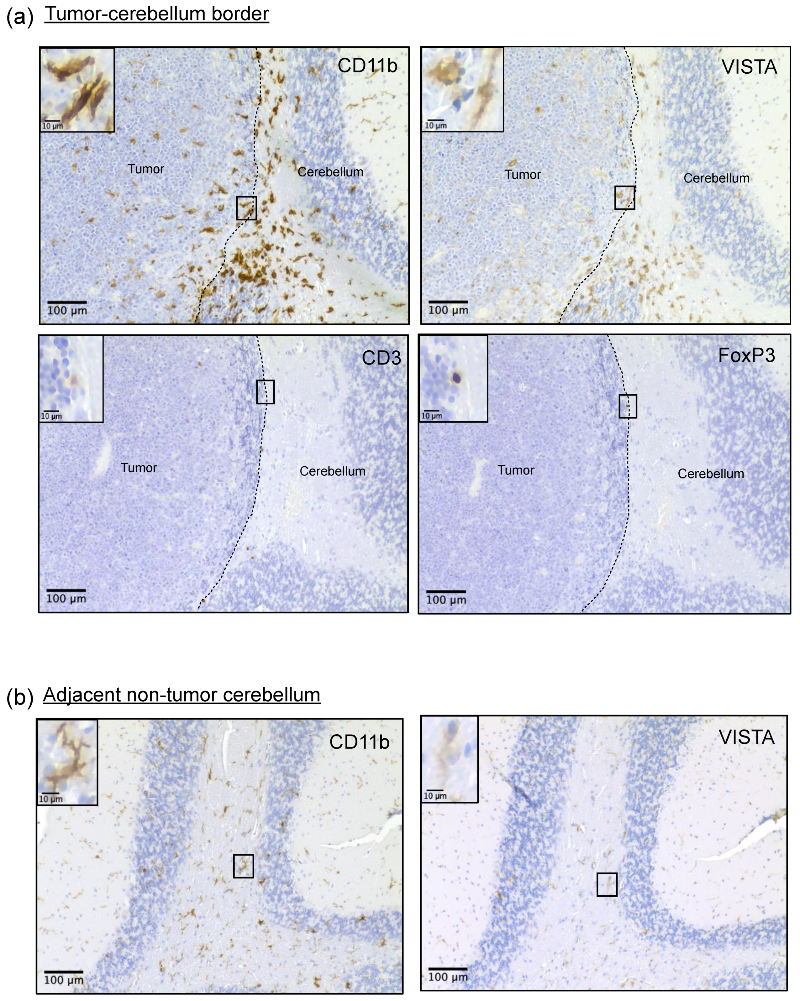 Cancers 16 02629 g003