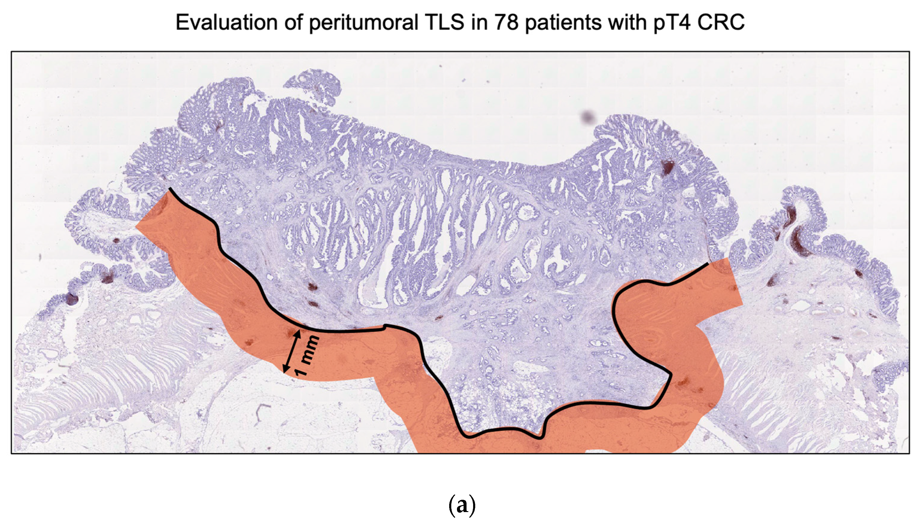 Cancers 16 02684 g001a