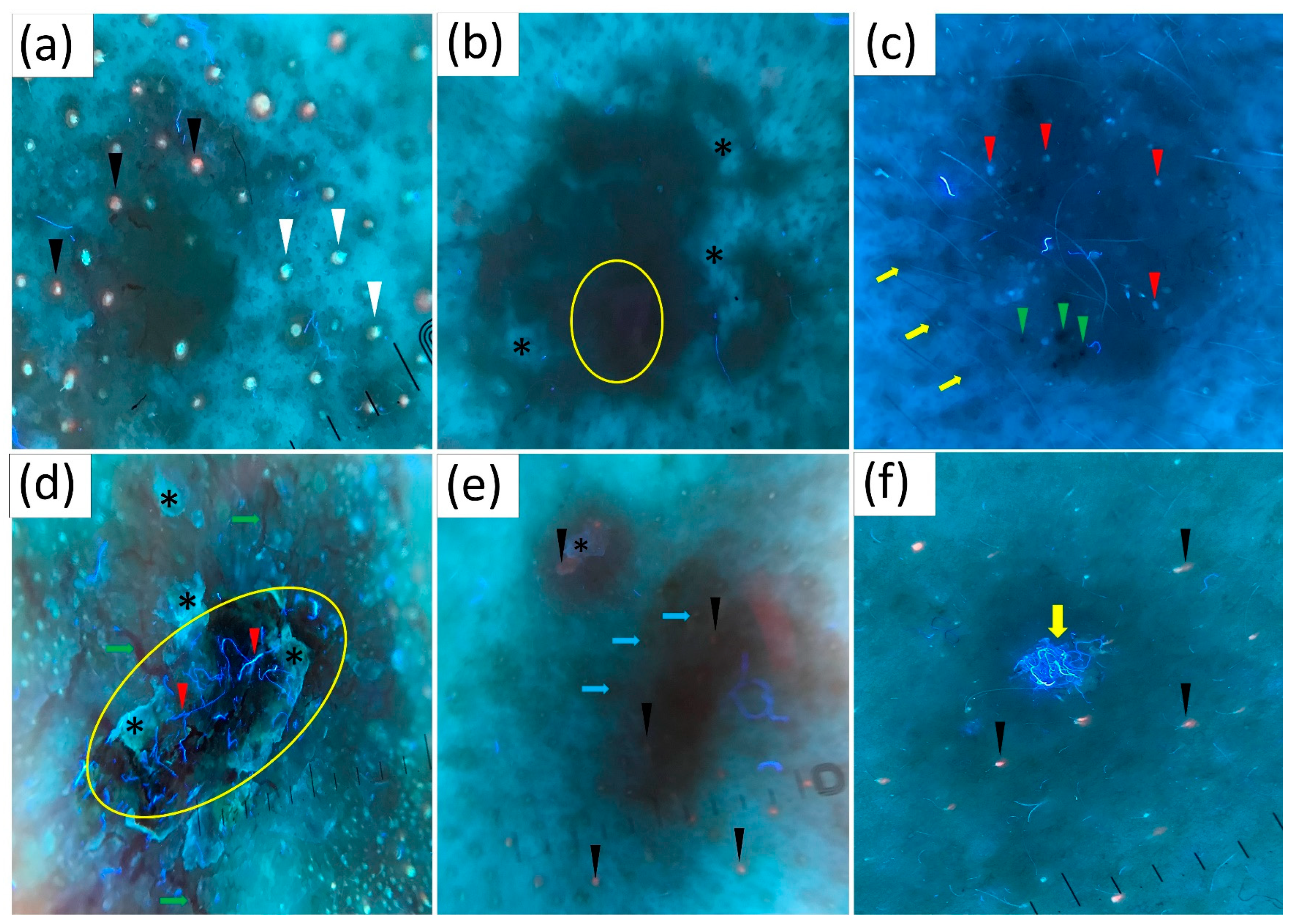 Cancers 16 02685 g001