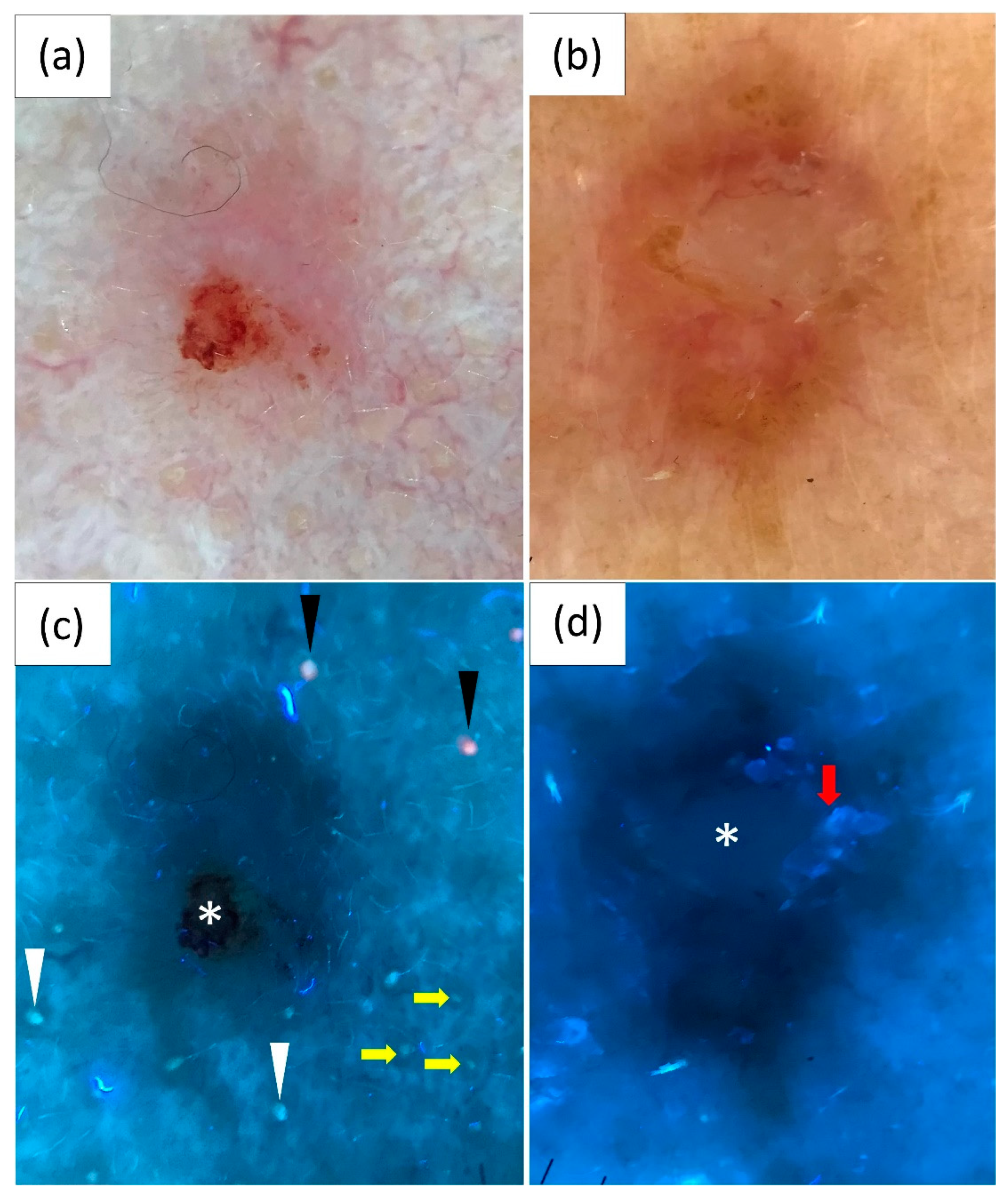 Cancers 16 02685 g002