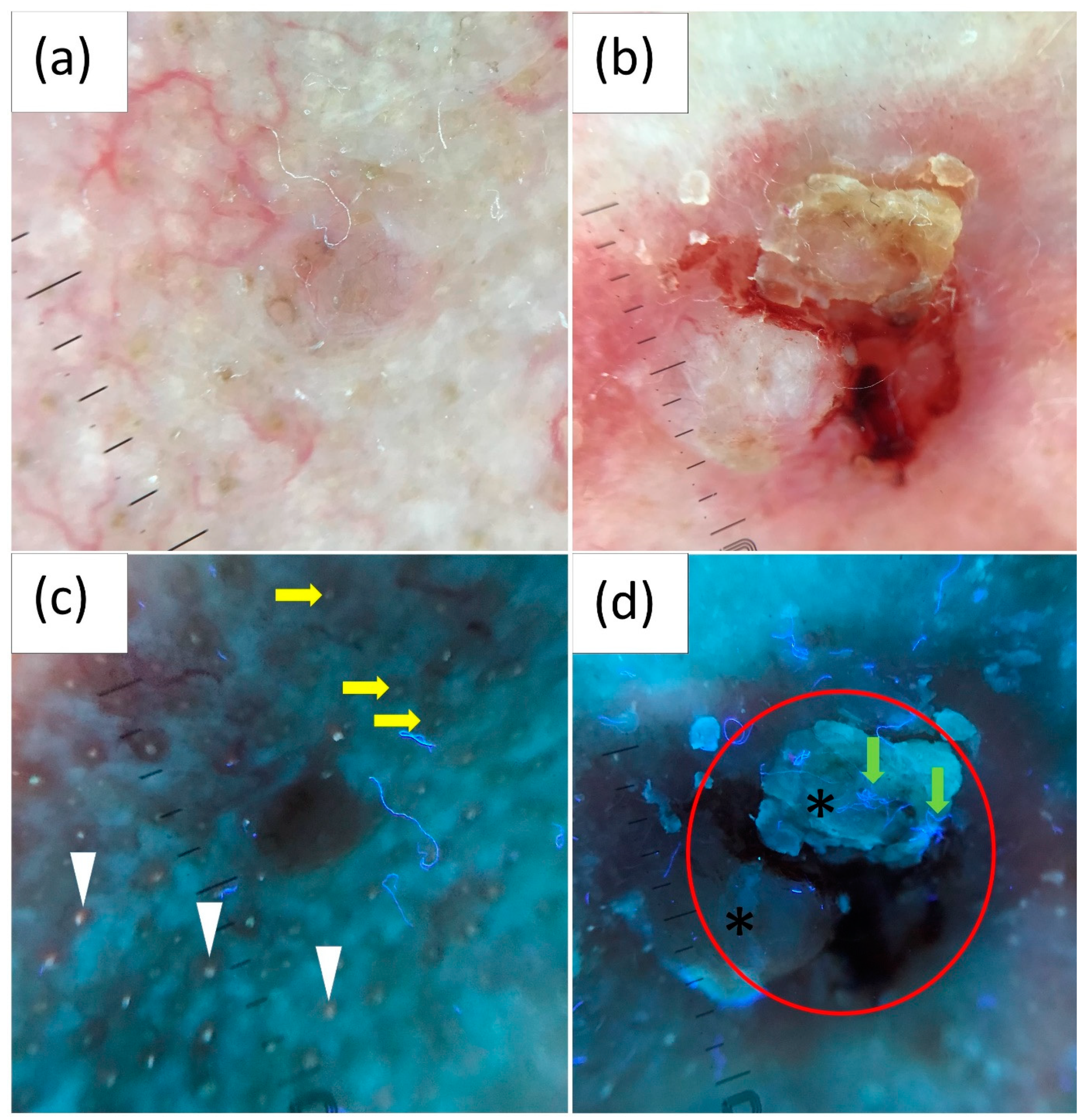 Cancers 16 02685 g003