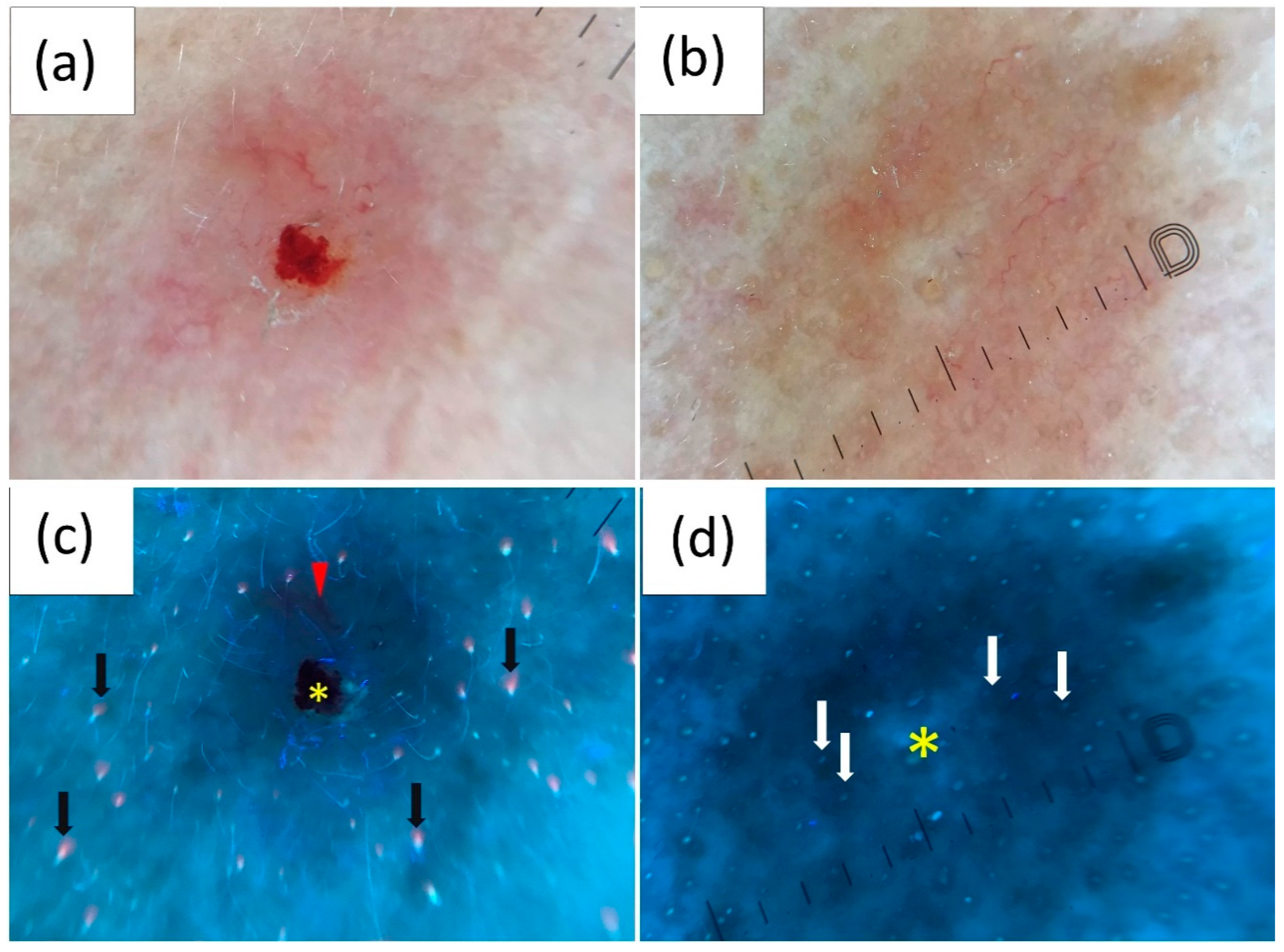 Cancers 16 02685 g004