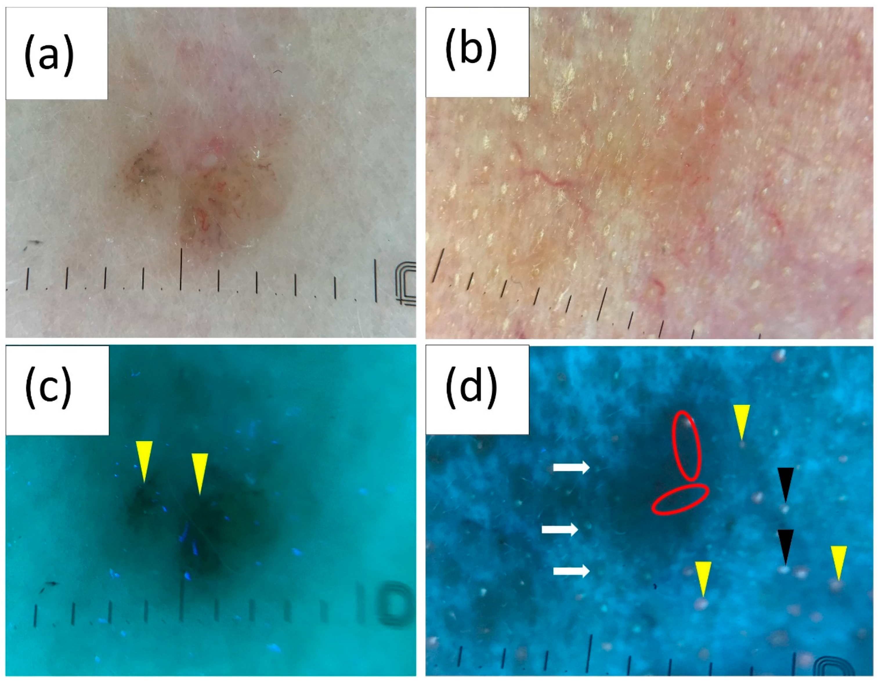 Cancers 16 02685 g005