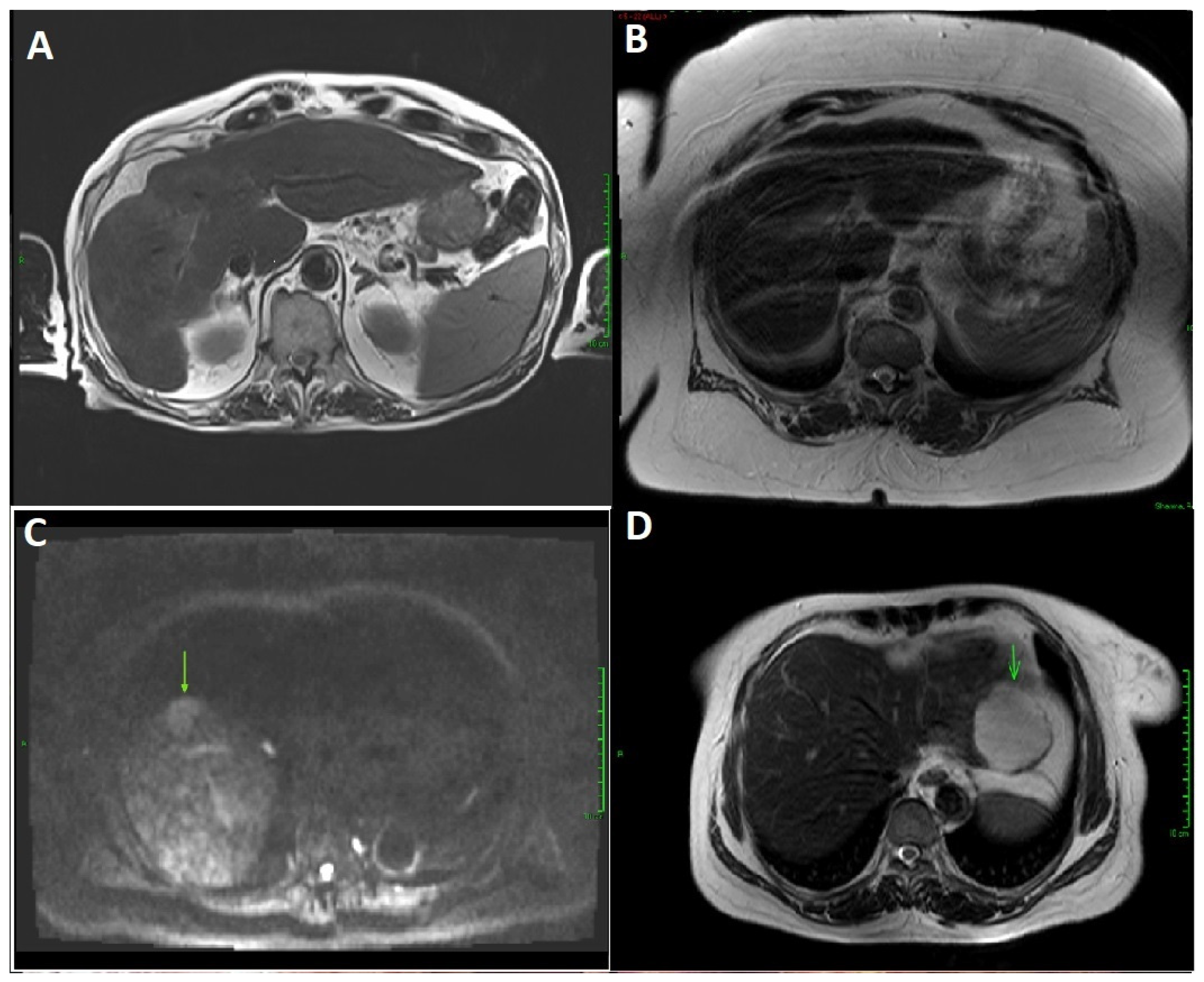 Cancers 16 02709 g003