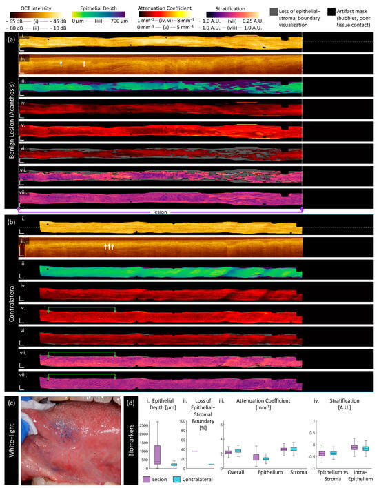 Cancers 16 02751 g004