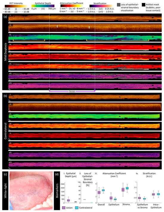 Cancers 16 02751 g005