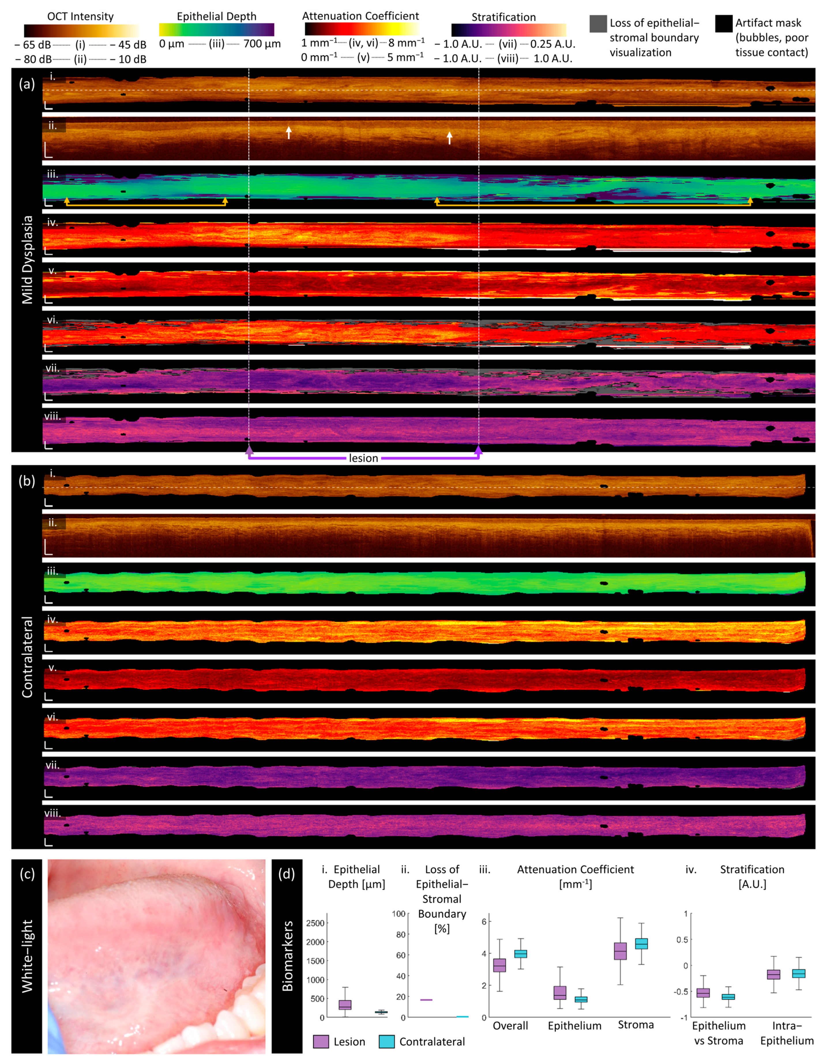 Cancers 16 02751 g005