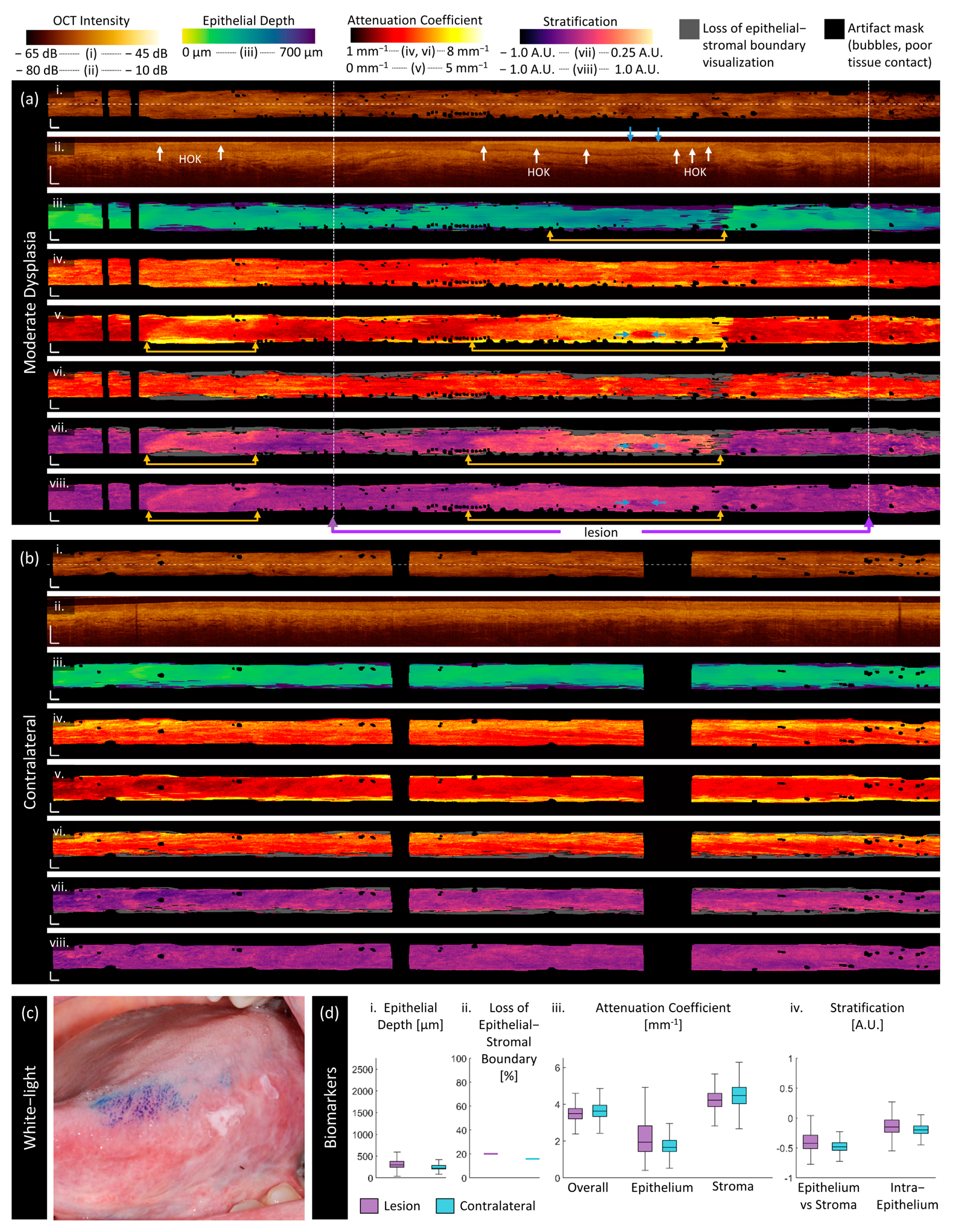 Cancers 16 02751 g006