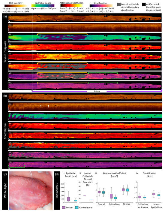 Cancers 16 02751 g007