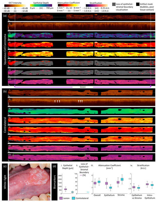 Cancers 16 02751 g008