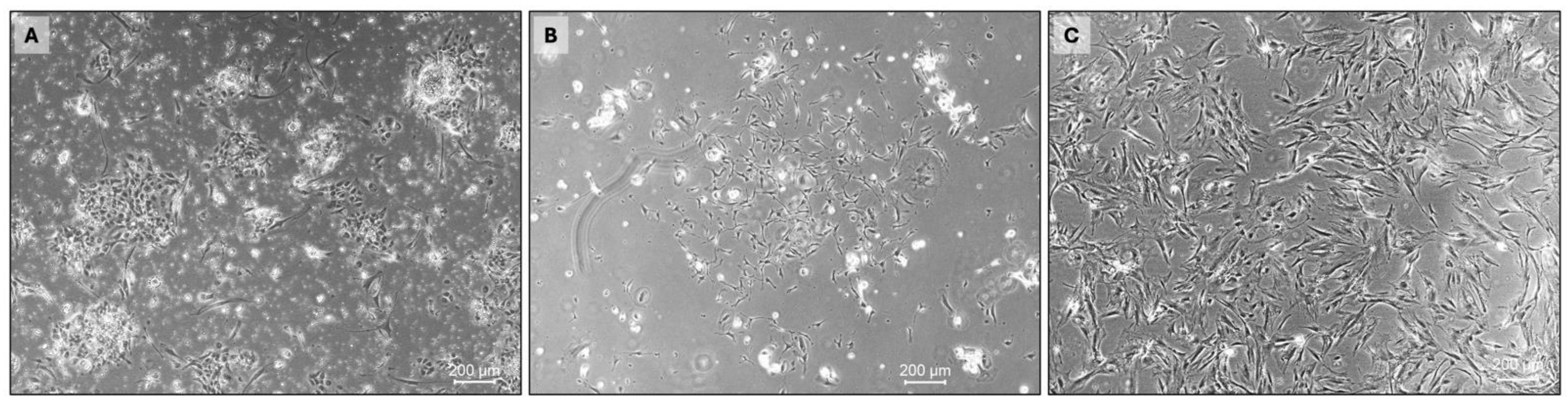 Cancers 16 02762 g002