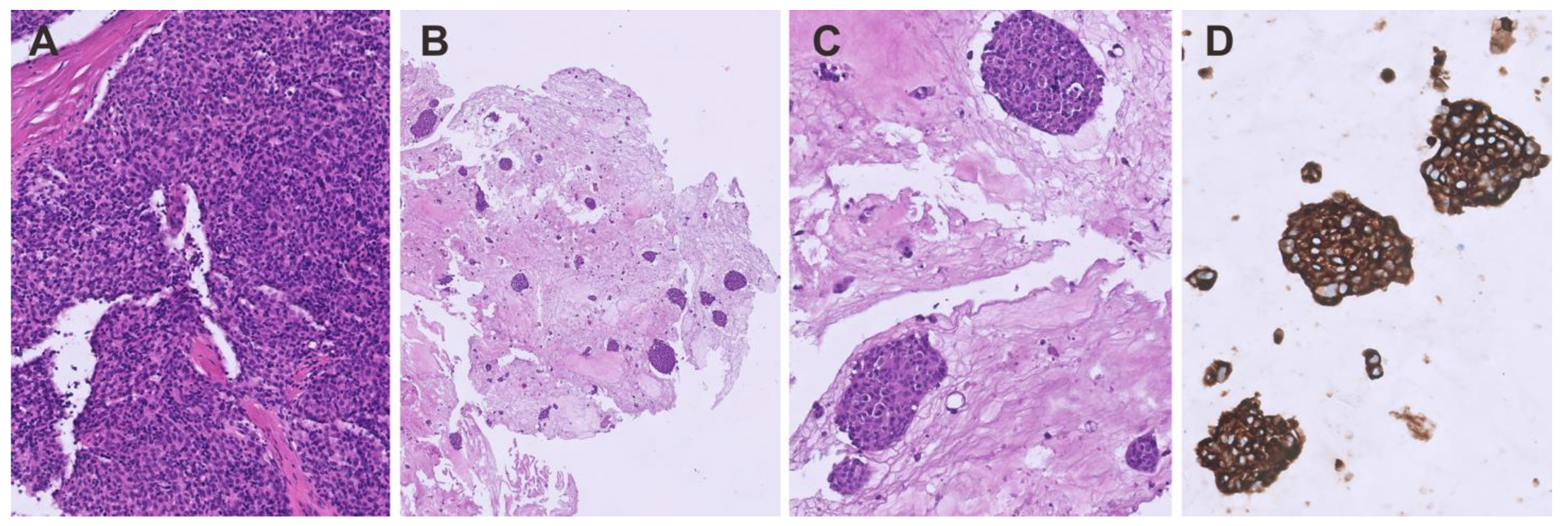 Cancers 16 02762 g003