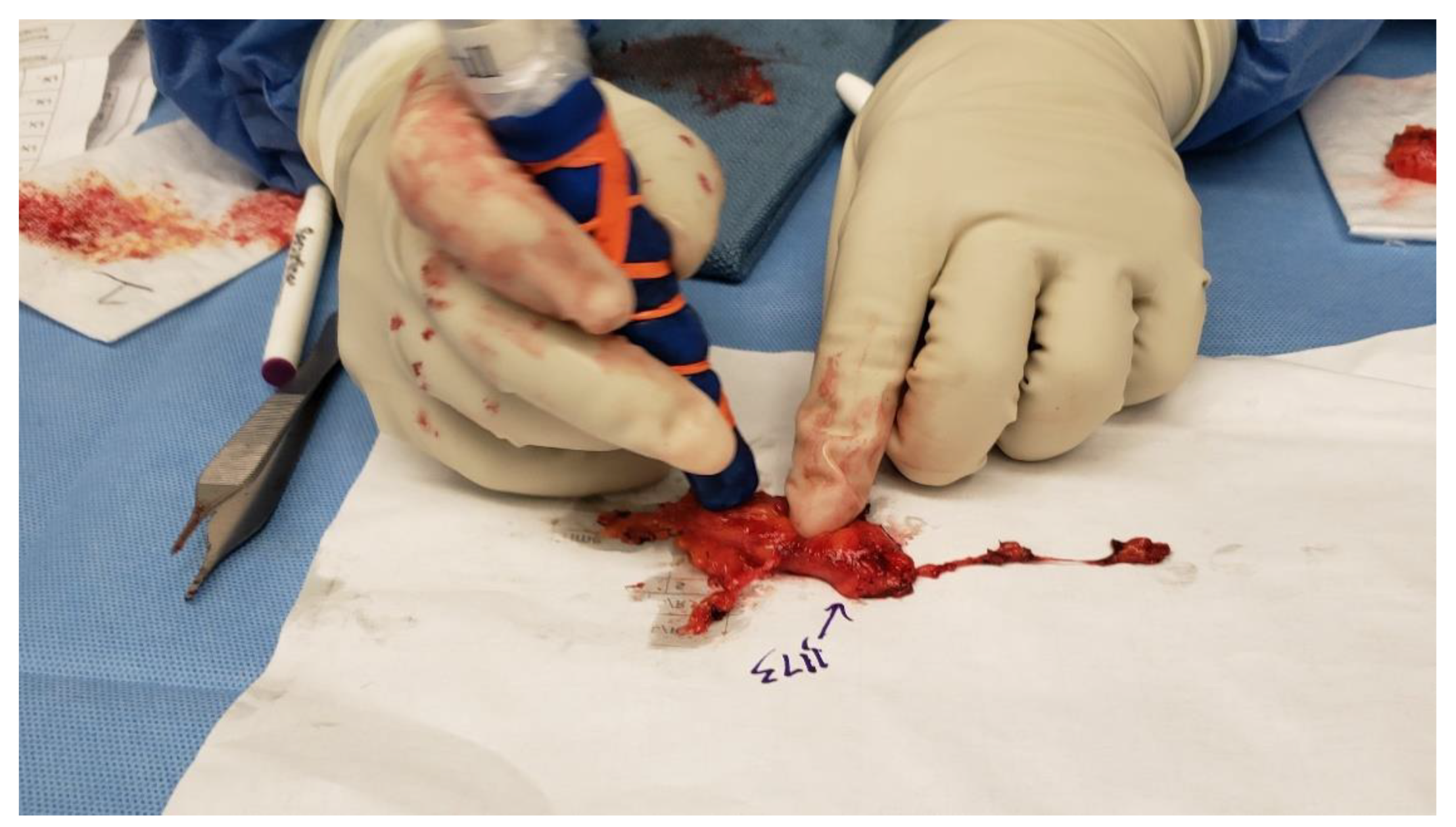 Cancers 16 02767 g003