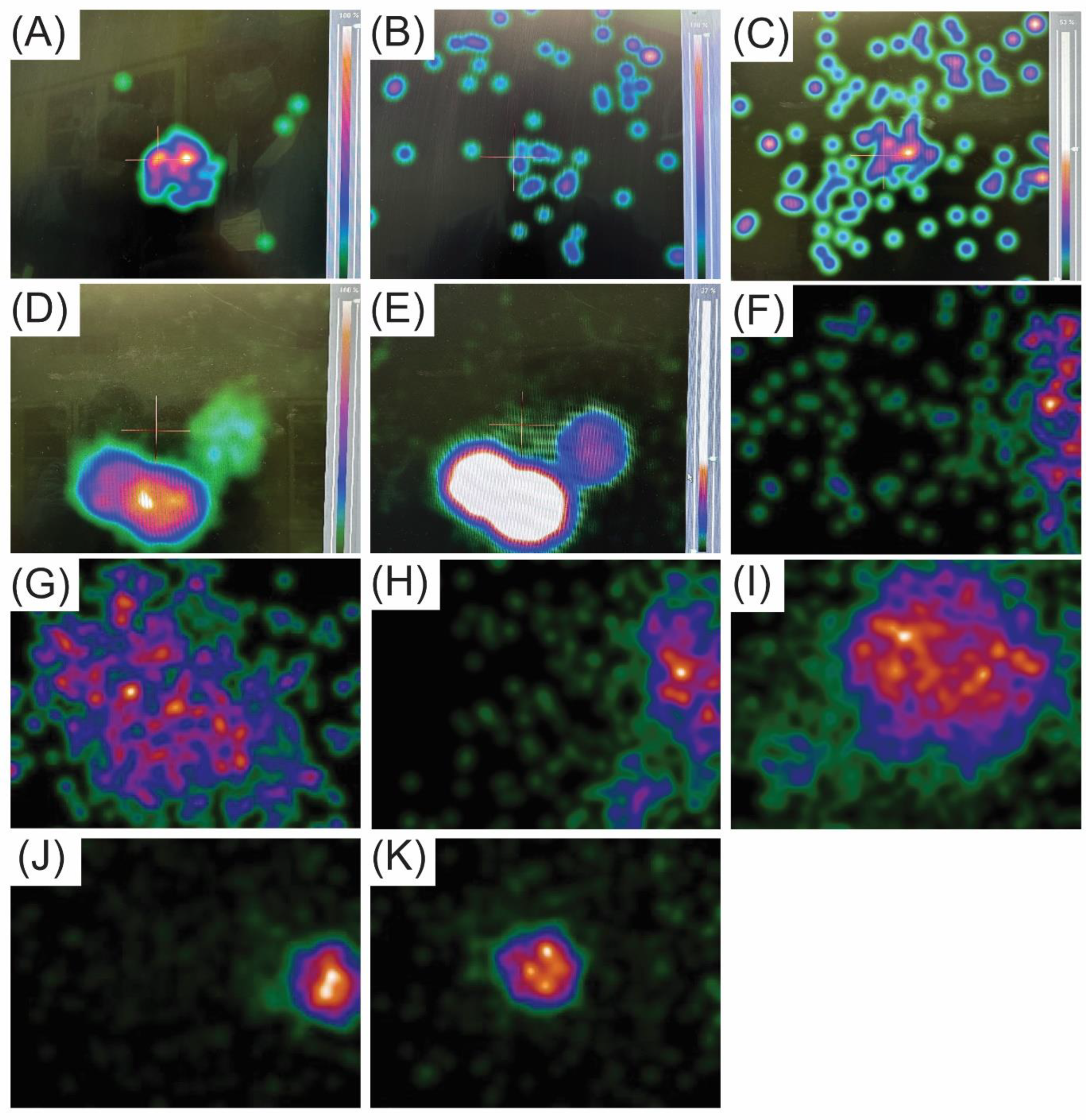 Cancers 16 02767 g005