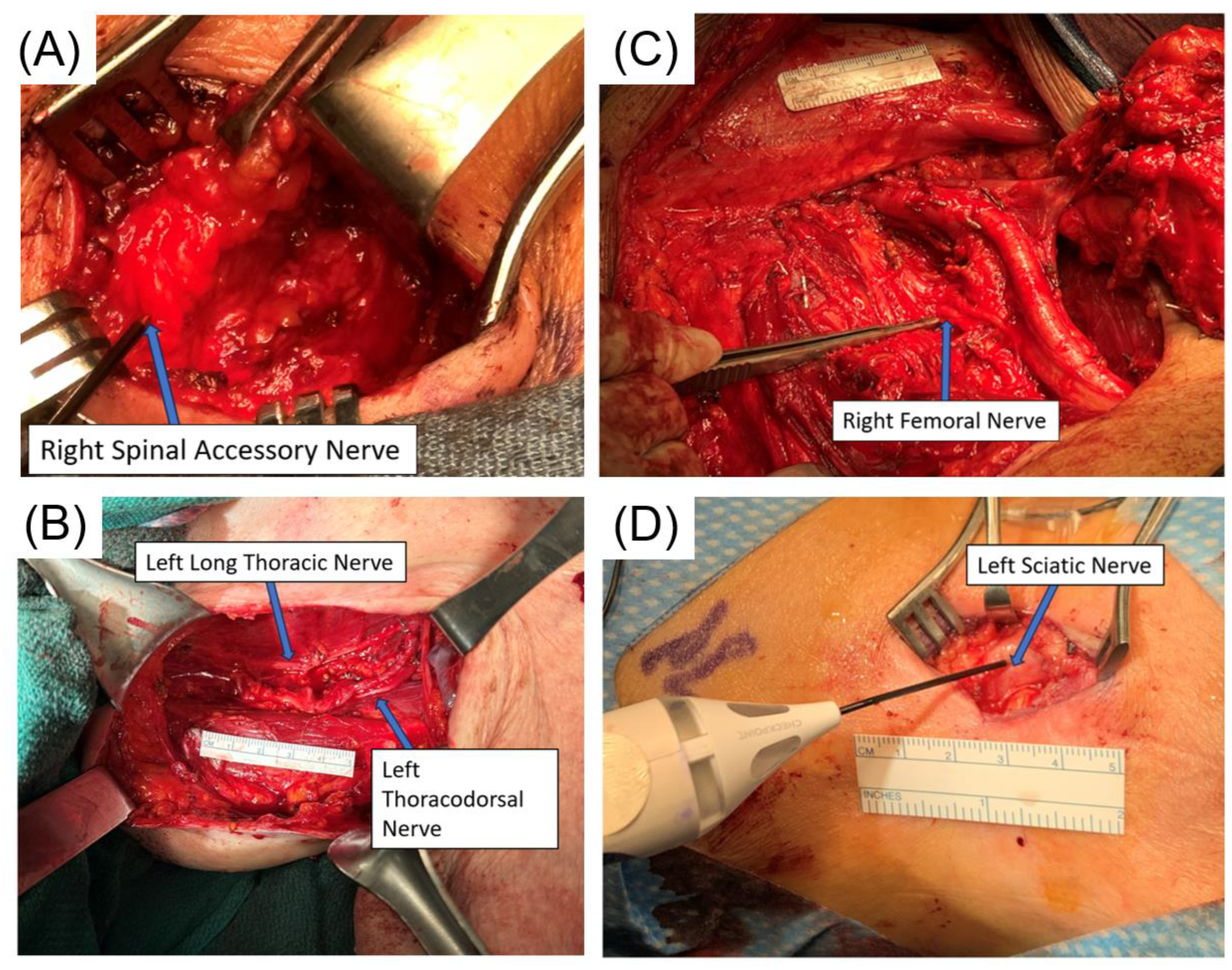 Cancers 16 02767 g006