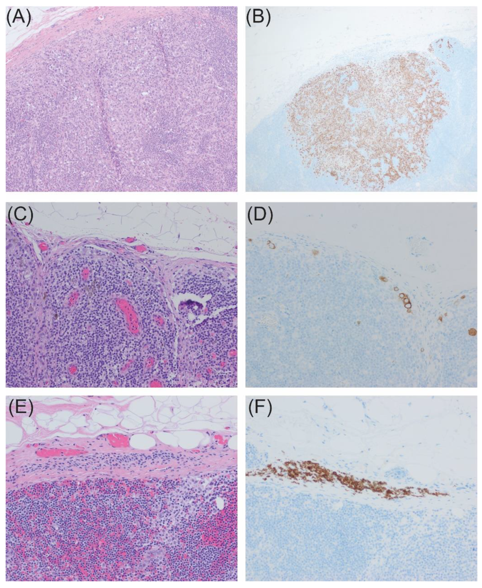 Cancers 16 02767 g009