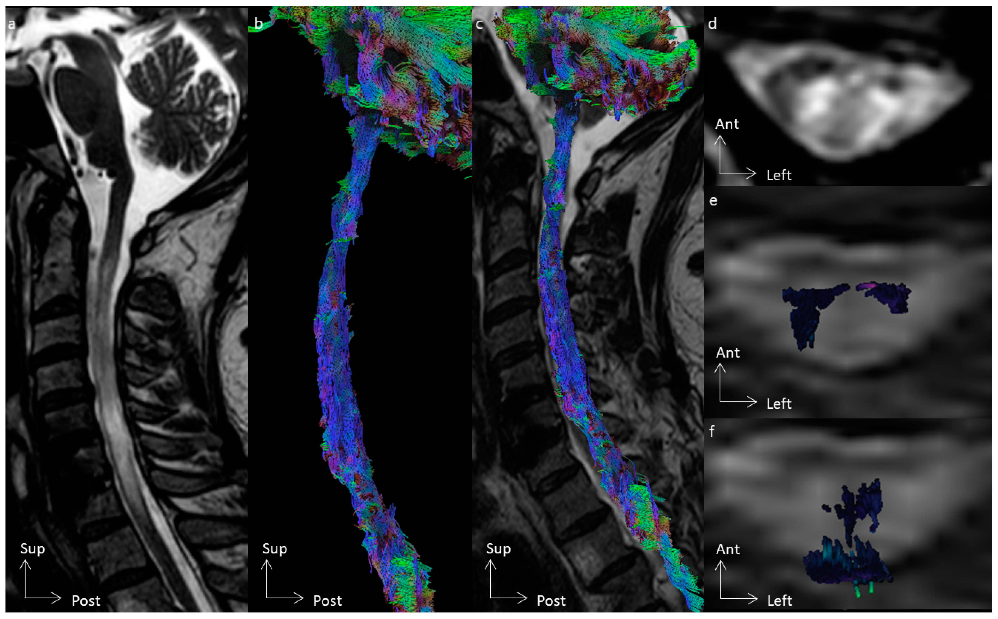 Cancers 16 02834 g005