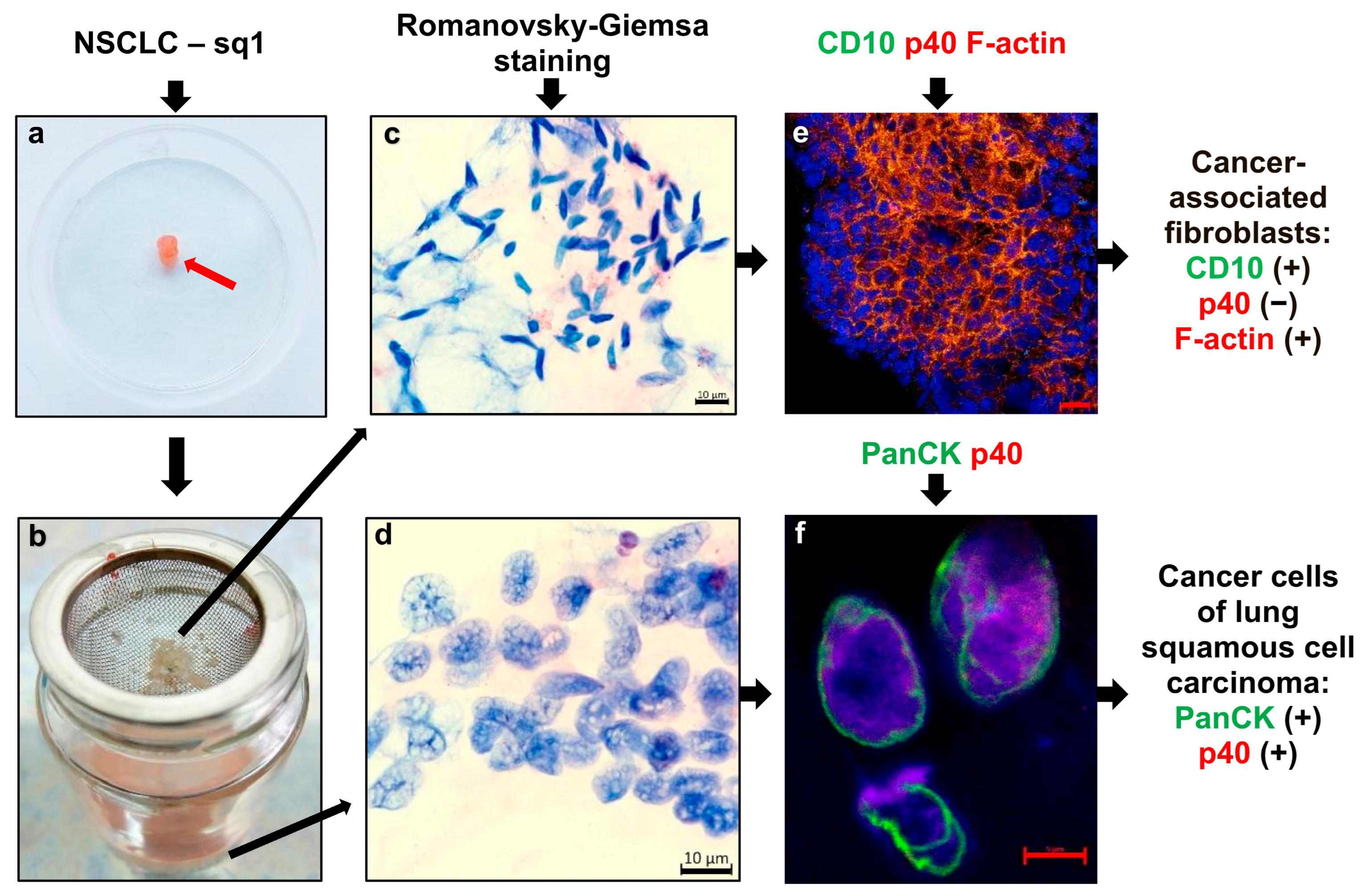 Cancers 16 02886 g001