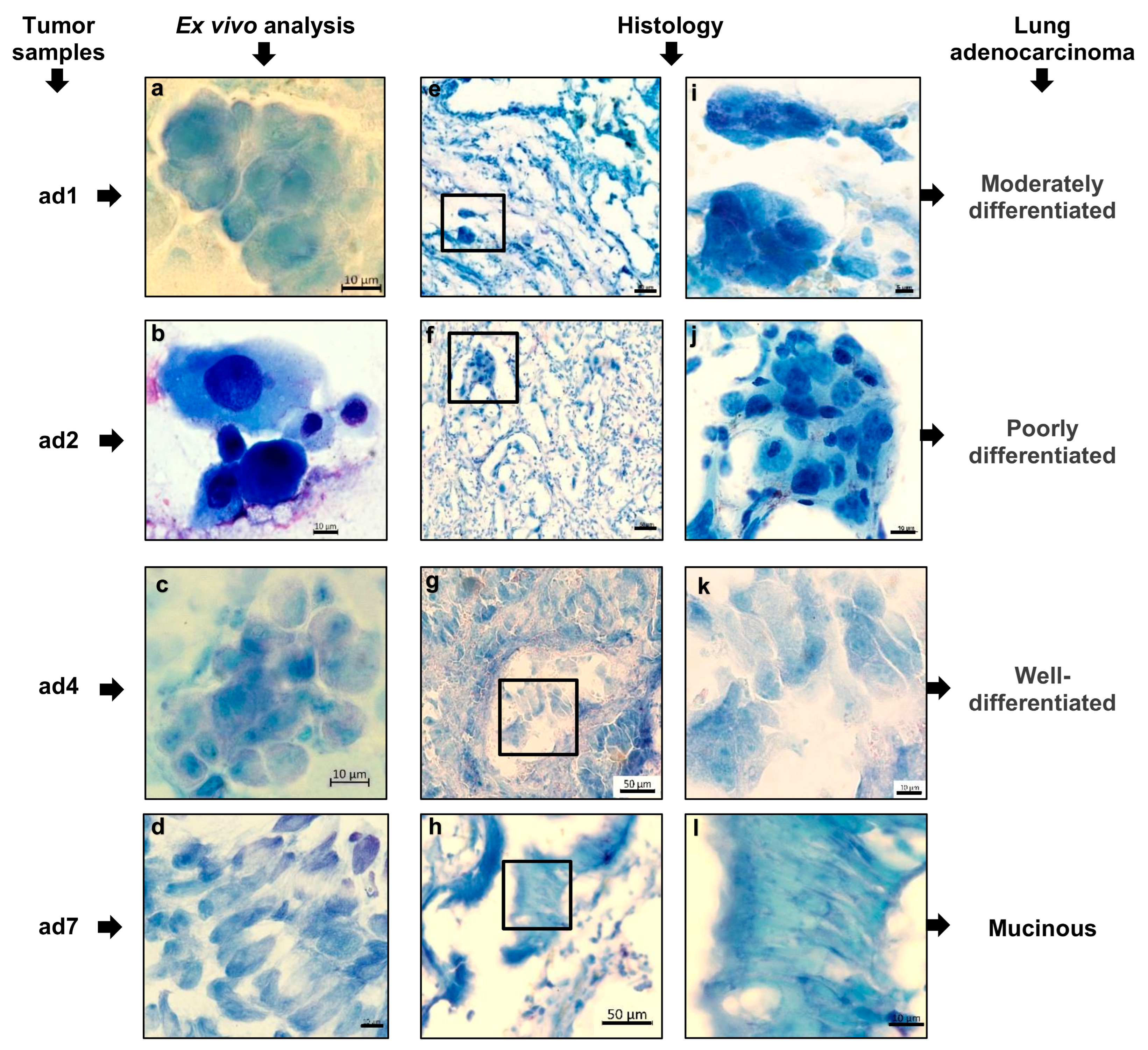 Cancers 16 02886 g002