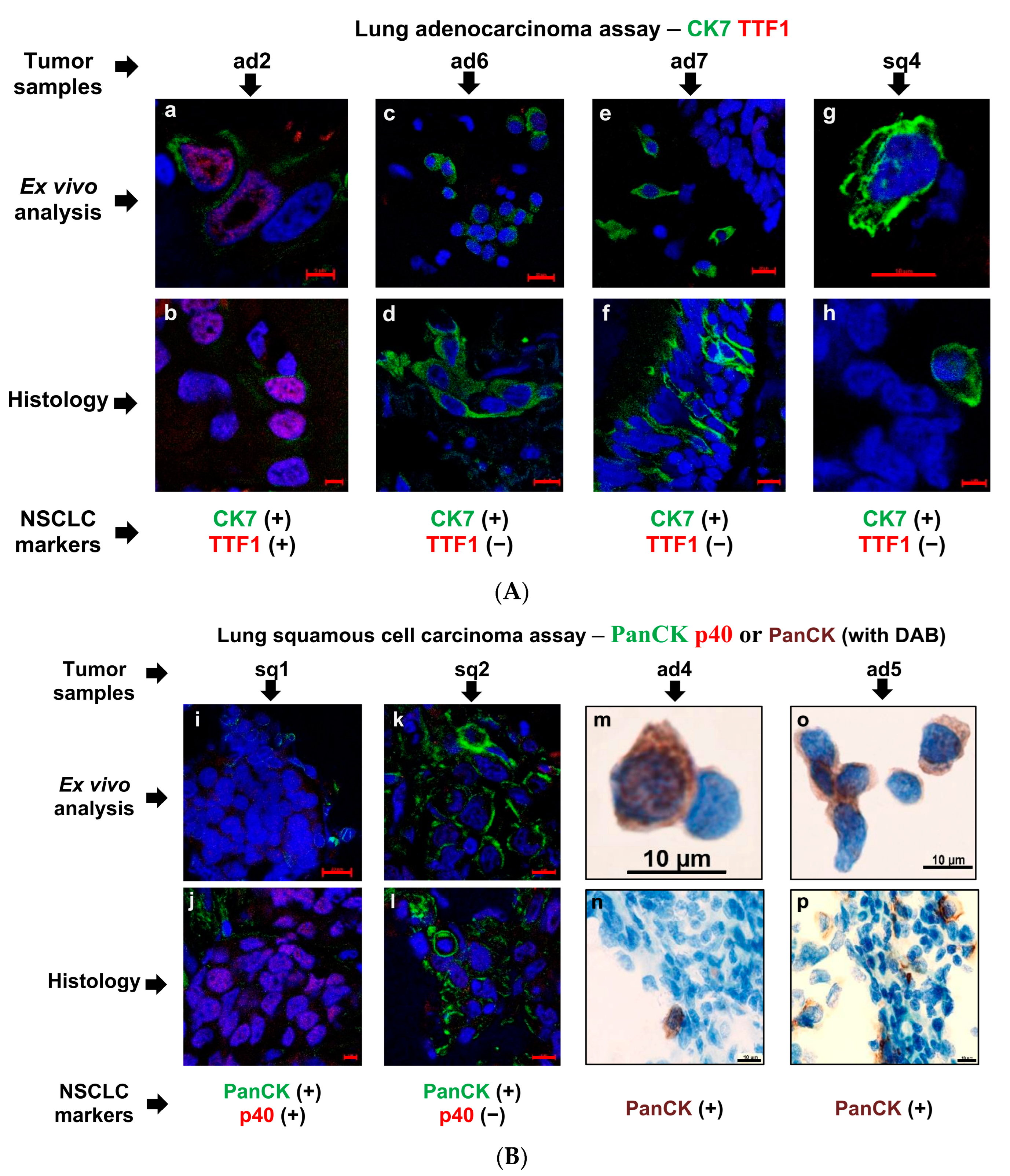 Cancers 16 02886 g003a